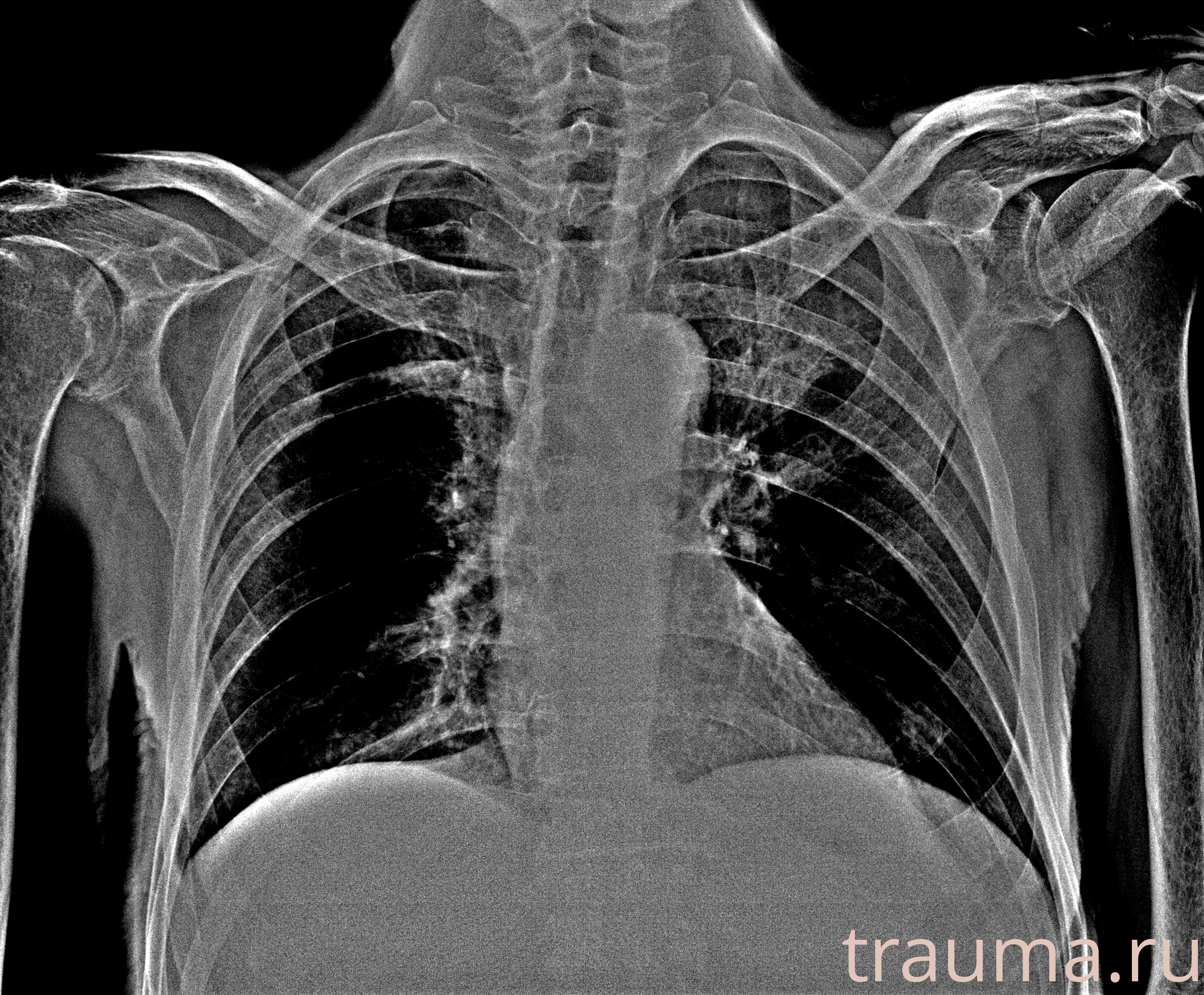 Рентген на дому: по вашему адресу приезжает врач-рентгенолог, травматолог-ортопед с мобильным рентгеновским аппаратом, проводит диагностику травмы или заболевания, делает необходимые рентгенограммы, дает рекомендации по дальнейшему лечению. Получить качественные снимки в домашних условиях возможно благодаря уникальной методике, разработанной МосРентген Центром для института  Склифосовского