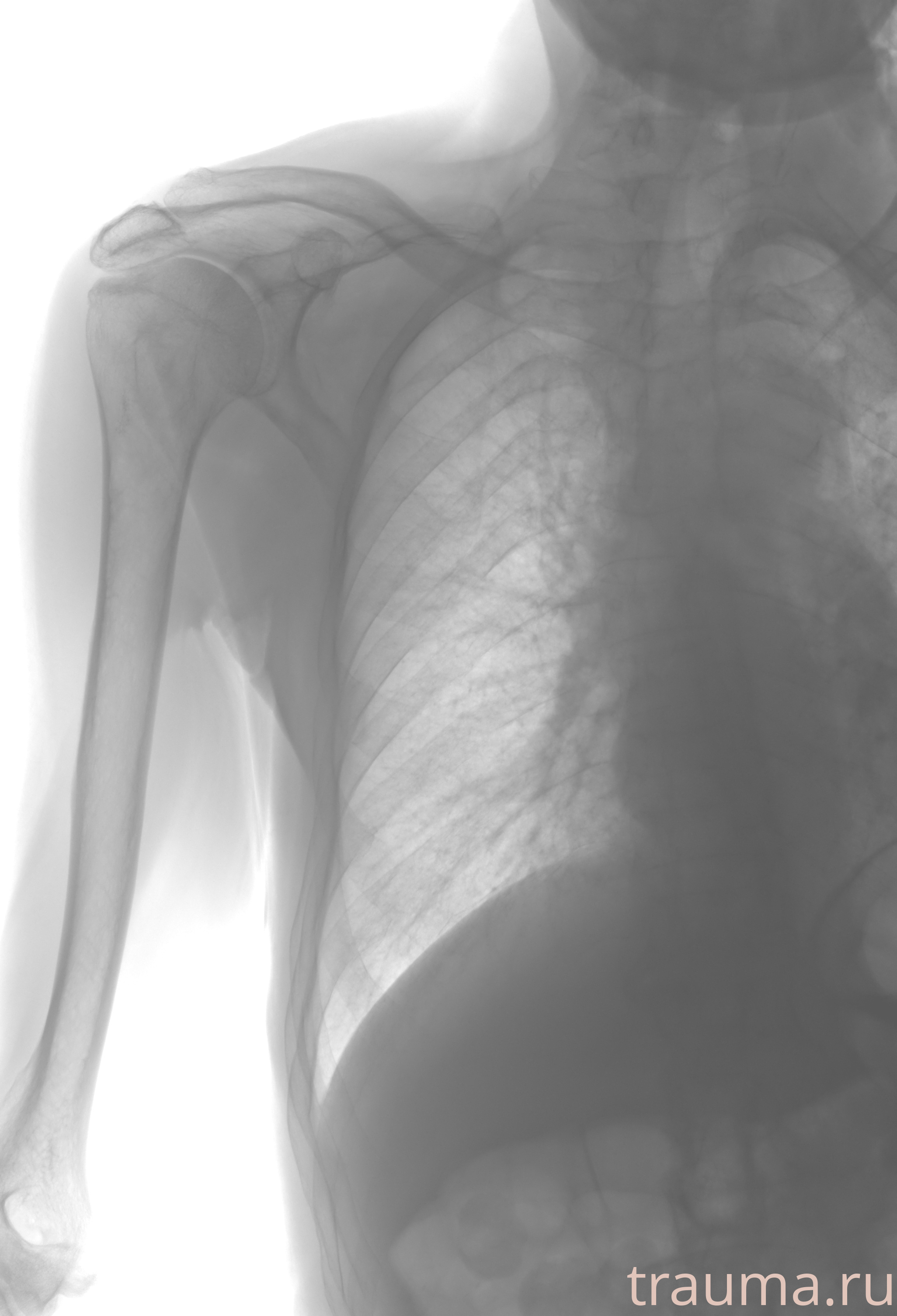 Рентген на дому: по вашему адресу приезжает врач-рентгенолог, травматолог-ортопед с мобильным рентгеновским аппаратом, проводит диагностику травмы или заболевания, делает необходимые рентгенограммы, дает рекомендации по дальнейшему лечению. Получить качественные снимки в домашних условиях возможно благодаря уникальной методике, разработанной МосРентген Центром для института  Склифосовского