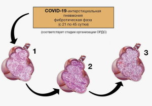 Влияние коморбидности на исход лечения больных тяжёлой COVTO-19-ассоциированной пневмонией
Влияние коморбидности на исход лечения больных тяжёлой COVTO-19-ассоциированной пневмонией