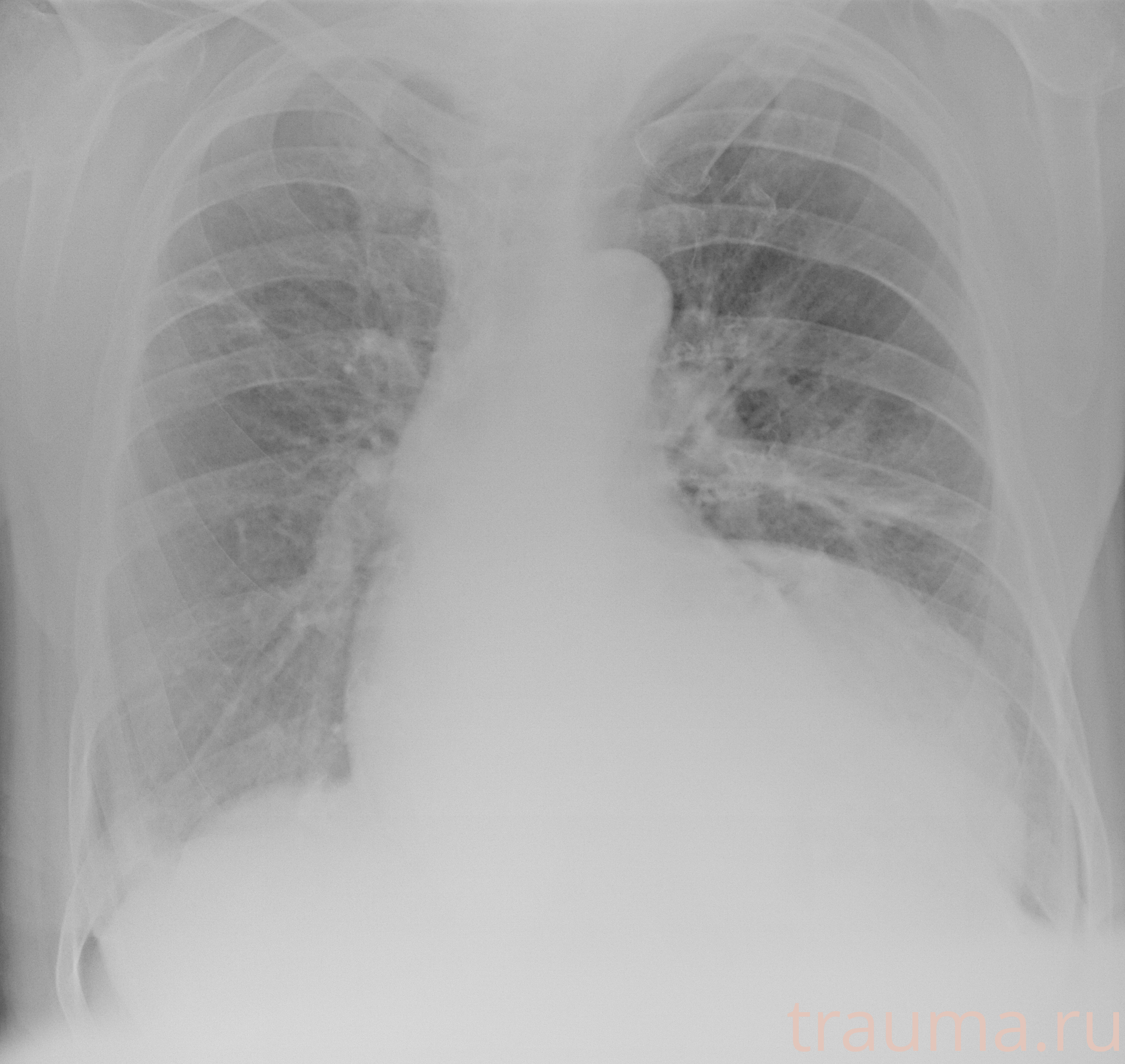 Рентген на дому: по вашему адресу приезжает врач-рентгенолог, травматолог-ортопед с мобильным рентгеновским аппаратом, проводит диагностику травмы или заболевания, делает необходимые рентгенограммы, дает рекомендации по дальнейшему лечению. Получить качественные снимки в домашних условиях возможно благодаря уникальной методике, разработанной МосРентген Центром для института  Склифосовского