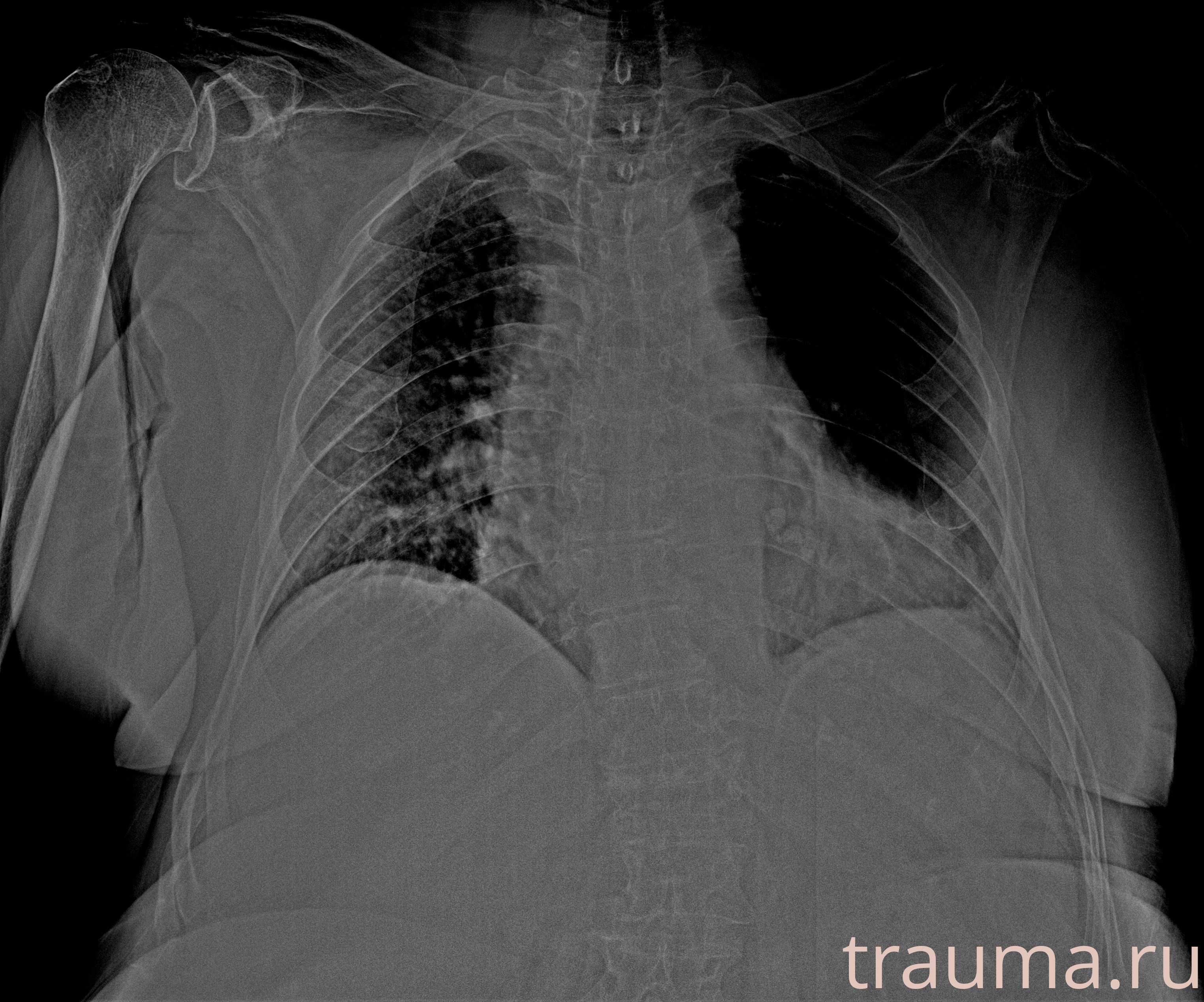 Рентген на дому: по вашему адресу приезжает врач-рентгенолог, травматолог-ортопед с мобильным рентгеновским аппаратом, проводит диагностику травмы или заболевания, делает необходимые рентгенограммы, дает рекомендации по дальнейшему лечению. Получить качественные снимки в домашних условиях возможно благодаря уникальной методике, разработанной МосРентген Центром для института  Склифосовского