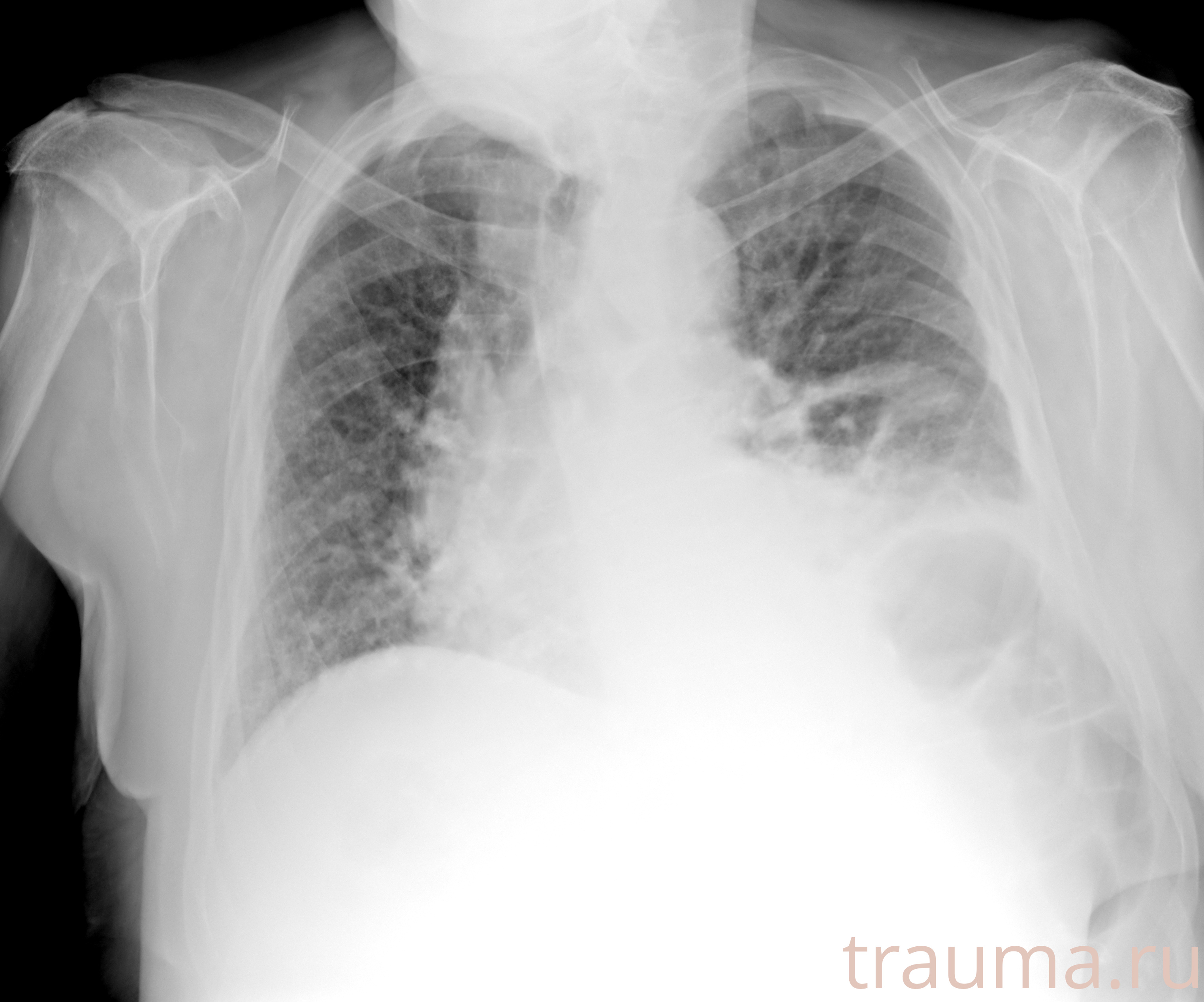 Рентген на дому: по вашему адресу приезжает врач-рентгенолог, травматолог-ортопед с мобильным рентгеновским аппаратом, проводит диагностику травмы или заболевания, делает необходимые рентгенограммы, дает рекомендации по дальнейшему лечению. Получить качественные снимки в домашних условиях возможно благодаря уникальной методике, разработанной МосРентген Центром для института  Склифосовского