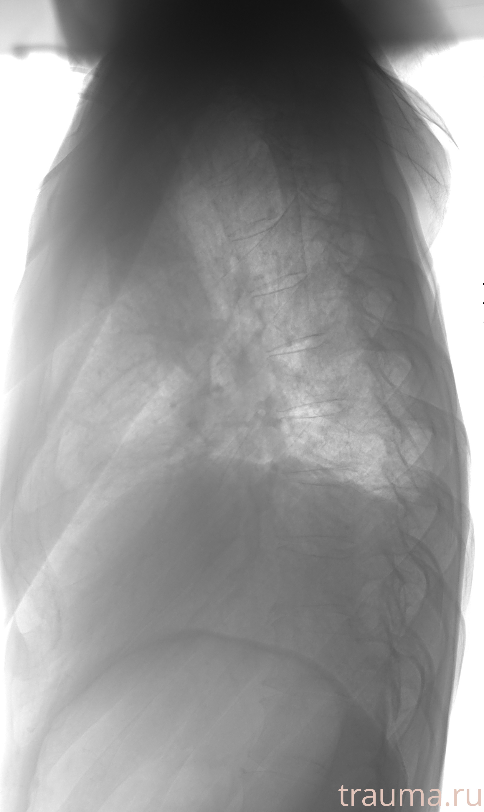 Рентген на дому: по вашему адресу приезжает врач-рентгенолог, травматолог-ортопед с мобильным рентгеновским аппаратом, проводит диагностику травмы или заболевания, делает необходимые рентгенограммы, дает рекомендации по дальнейшему лечению. Получить качественные снимки в домашних условиях возможно благодаря уникальной методике, разработанной МосРентген Центром для института  Склифосовского
