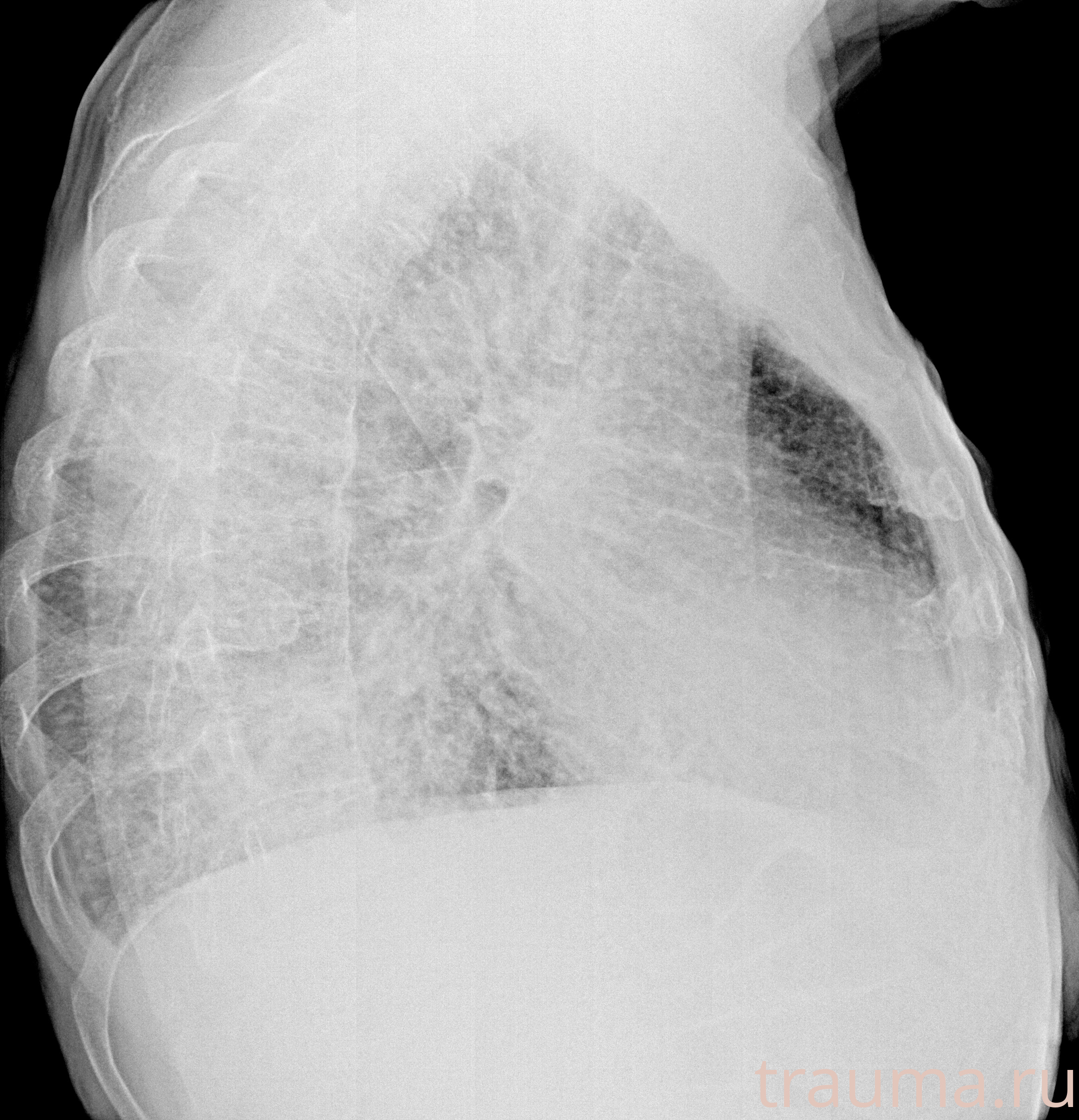 Рентген на дому: по вашему адресу приезжает врач-рентгенолог, травматолог-ортопед с мобильным рентгеновским аппаратом, проводит диагностику травмы или заболевания, делает необходимые рентгенограммы, дает рекомендации по дальнейшему лечению. Получить качественные снимки в домашних условиях возможно благодаря уникальной методике, разработанной МосРентген Центром для института  Склифосовского