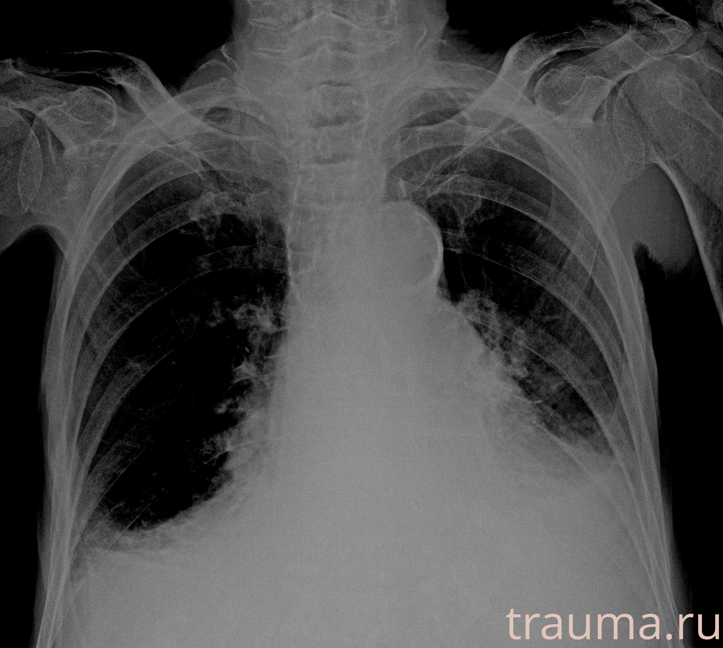 Рентген на дому: по вашему адресу приезжает врач-рентгенолог, травматолог-ортопед с мобильным рентгеновским аппаратом, проводит диагностику травмы или заболевания, делает необходимые рентгенограммы, дает рекомендации по дальнейшему лечению. Получить качественные снимки в домашних условиях возможно благодаря уникальной методике, разработанной МосРентген Центром для института  Склифосовского