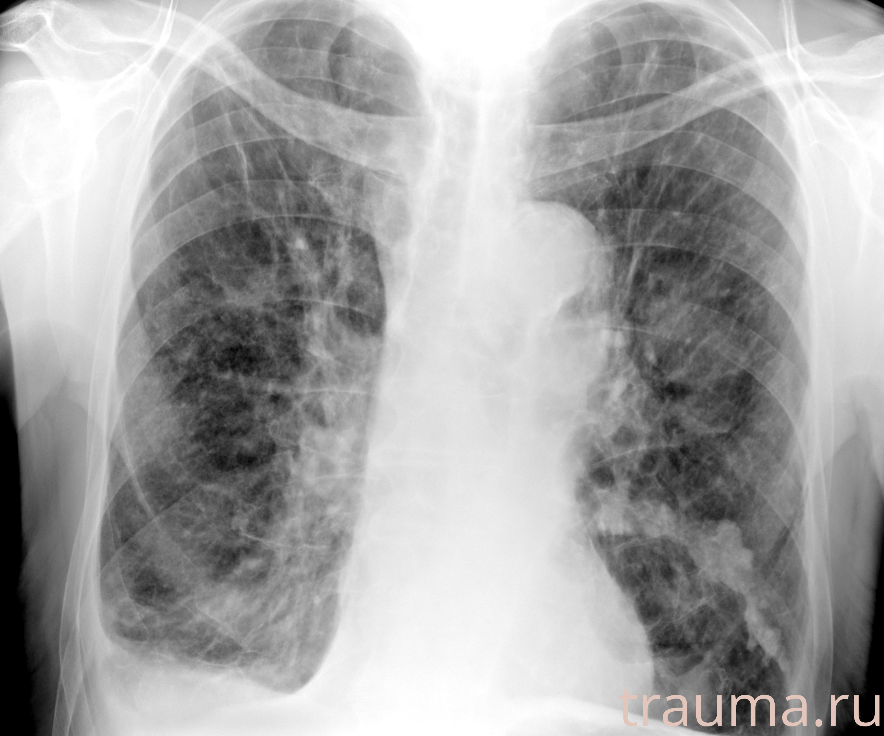 Рентген на дому: по вашему адресу приезжает врач-рентгенолог, травматолог-ортопед с мобильным рентгеновским аппаратом, проводит диагностику травмы или заболевания, делает необходимые рентгенограммы, дает рекомендации по дальнейшему лечению. Получить качественные снимки в домашних условиях возможно благодаря уникальной методике, разработанной МосРентген Центром для института  Склифосовского