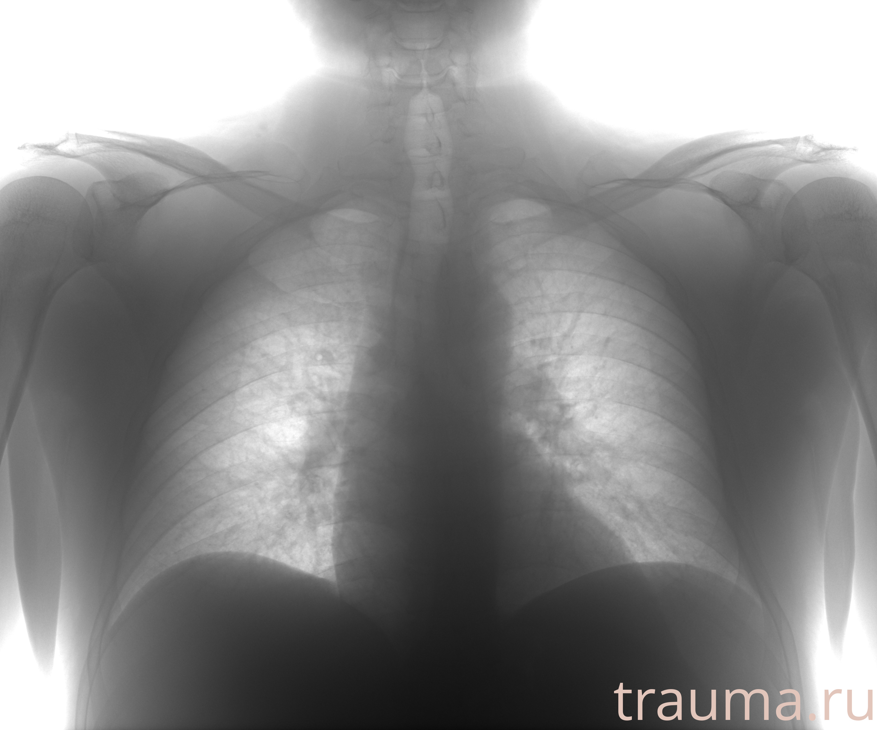 Рентген на дому: по вашему адресу приезжает врач-рентгенолог, травматолог-ортопед с мобильным рентгеновским аппаратом, проводит диагностику травмы или заболевания, делает необходимые рентгенограммы, дает рекомендации по дальнейшему лечению. Получить качественные снимки в домашних условиях возможно благодаря уникальной методике, разработанной МосРентген Центром для института  Склифосовского