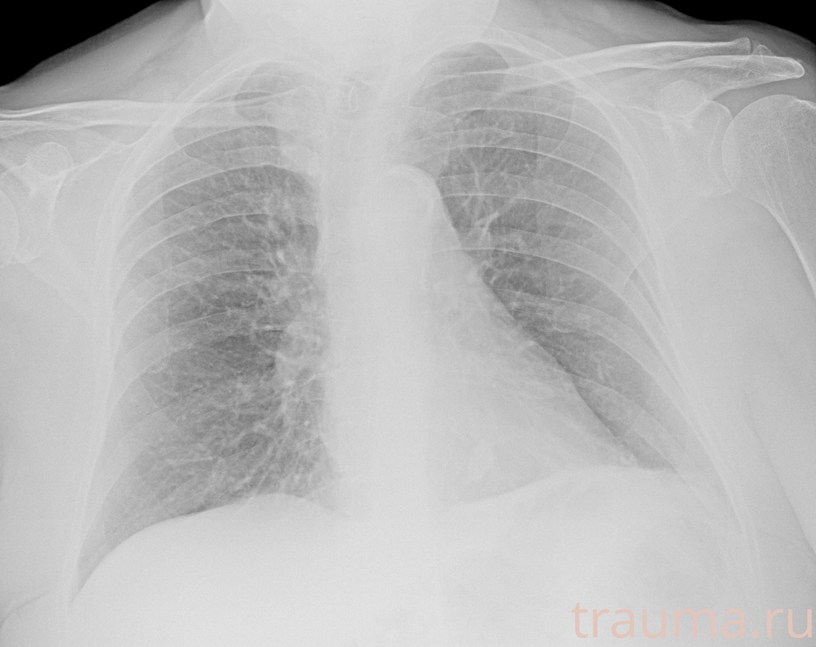 Рентген на дому: по вашему адресу приезжает врач-рентгенолог, травматолог-ортопед с мобильным рентгеновским аппаратом, проводит диагностику травмы или заболевания, делает необходимые рентгенограммы, дает рекомендации по дальнейшему лечению. Получить качественные снимки в домашних условиях возможно благодаря уникальной методике, разработанной МосРентген Центром для института  Склифосовского