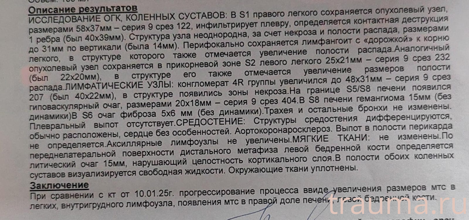 Рентген на дому: по вашему адресу приезжает врач-рентгенолог, травматолог-ортопед с мобильным рентгеновским аппаратом, проводит диагностику травмы или заболевания, делает необходимые рентгенограммы, дает рекомендации по дальнейшему лечению. Получить качественные снимки в домашних условиях возможно благодаря уникальной методике, разработанной МосРентген Центром для института  Склифосовского