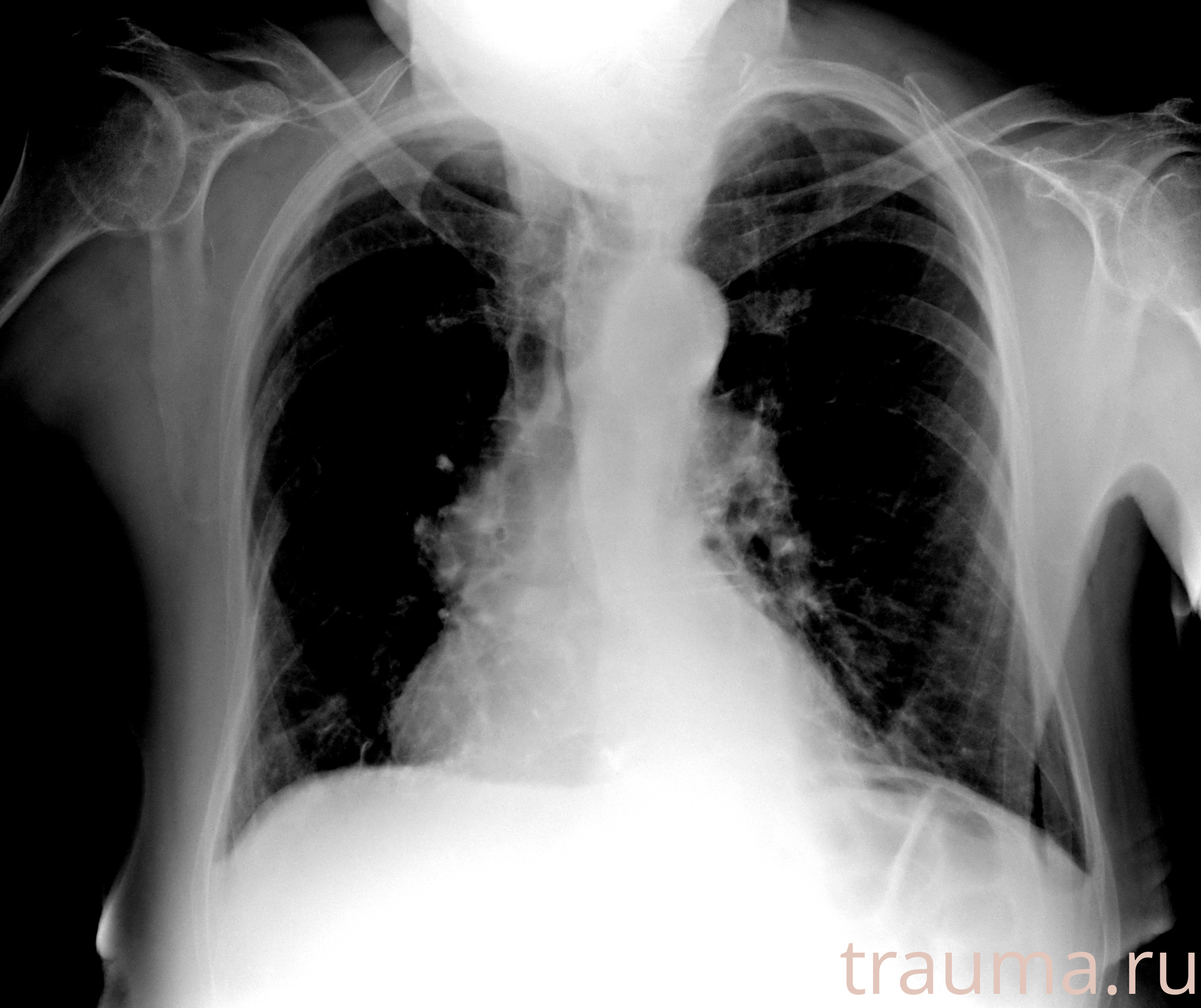 Рентген на дому: по вашему адресу приезжает врач-рентгенолог, травматолог-ортопед с мобильным рентгеновским аппаратом, проводит диагностику травмы или заболевания, делает необходимые рентгенограммы, дает рекомендации по дальнейшему лечению. Получить качественные снимки в домашних условиях возможно благодаря уникальной методике, разработанной МосРентген Центром для института  Склифосовского