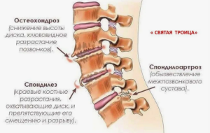 Реабилитация больных с заболеваниями и травмой шейного отдела позвоночника в раннем и позднем послеоперационном периоде анализ российских и зарубежных рекомендаций) Реабилитация больных с заболеваниями и травмой шейного отдела позвоночника в раннем и позднем послеоперационном периоде анализ российских и зарубежных рекомендаций)