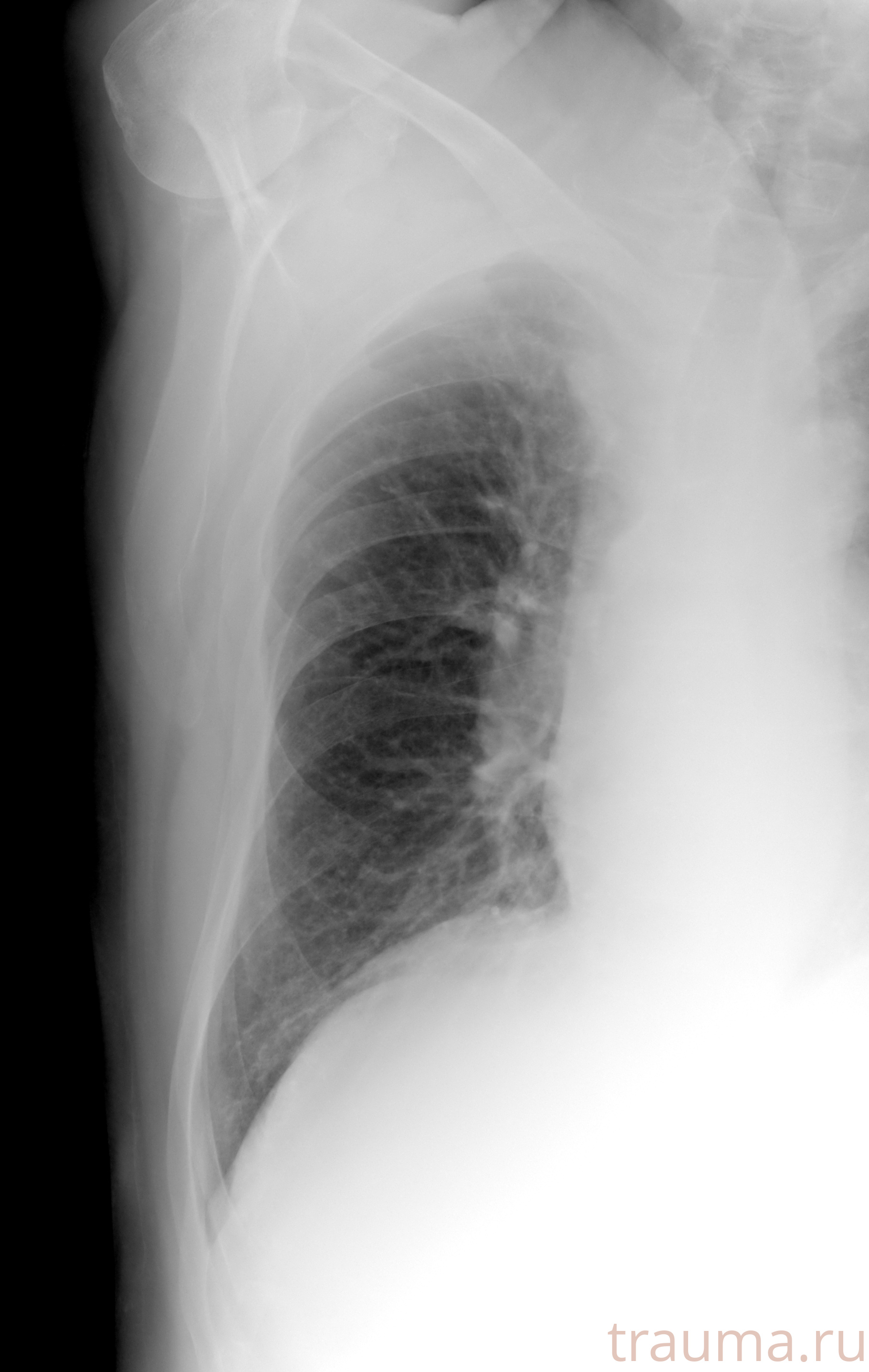 Рентген на дому: по вашему адресу приезжает врач-рентгенолог, травматолог-ортопед с мобильным рентгеновским аппаратом, проводит диагностику травмы или заболевания, делает необходимые рентгенограммы, дает рекомендации по дальнейшему лечению. Получить качественные снимки в домашних условиях возможно благодаря уникальной методике, разработанной МосРентген Центром для института  Склифосовского