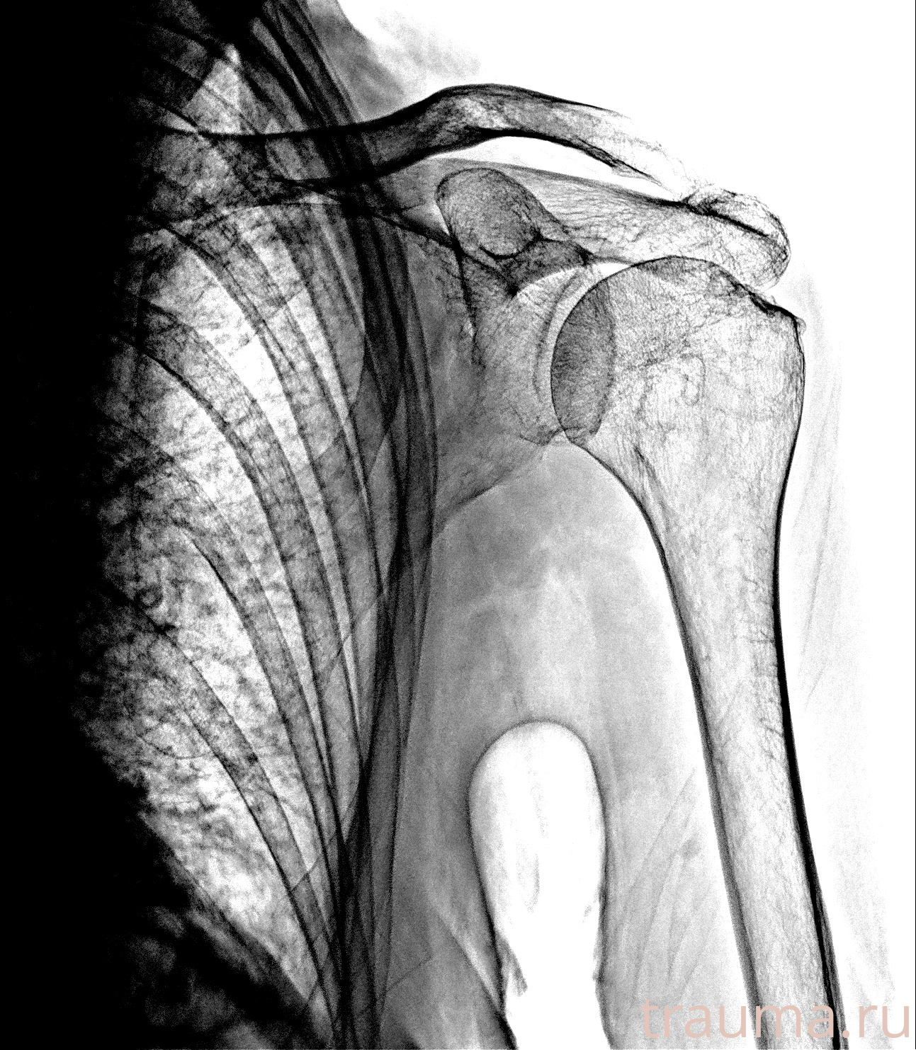 Рентген на дому: по вашему адресу приезжает врач-рентгенолог, травматолог-ортопед с мобильным рентгеновским аппаратом, проводит диагностику травмы или заболевания, делает необходимые рентгенограммы, дает рекомендации по дальнейшему лечению. Получить качественные снимки в домашних условиях возможно благодаря уникальной методике, разработанной МосРентген Центром для института  Склифосовского