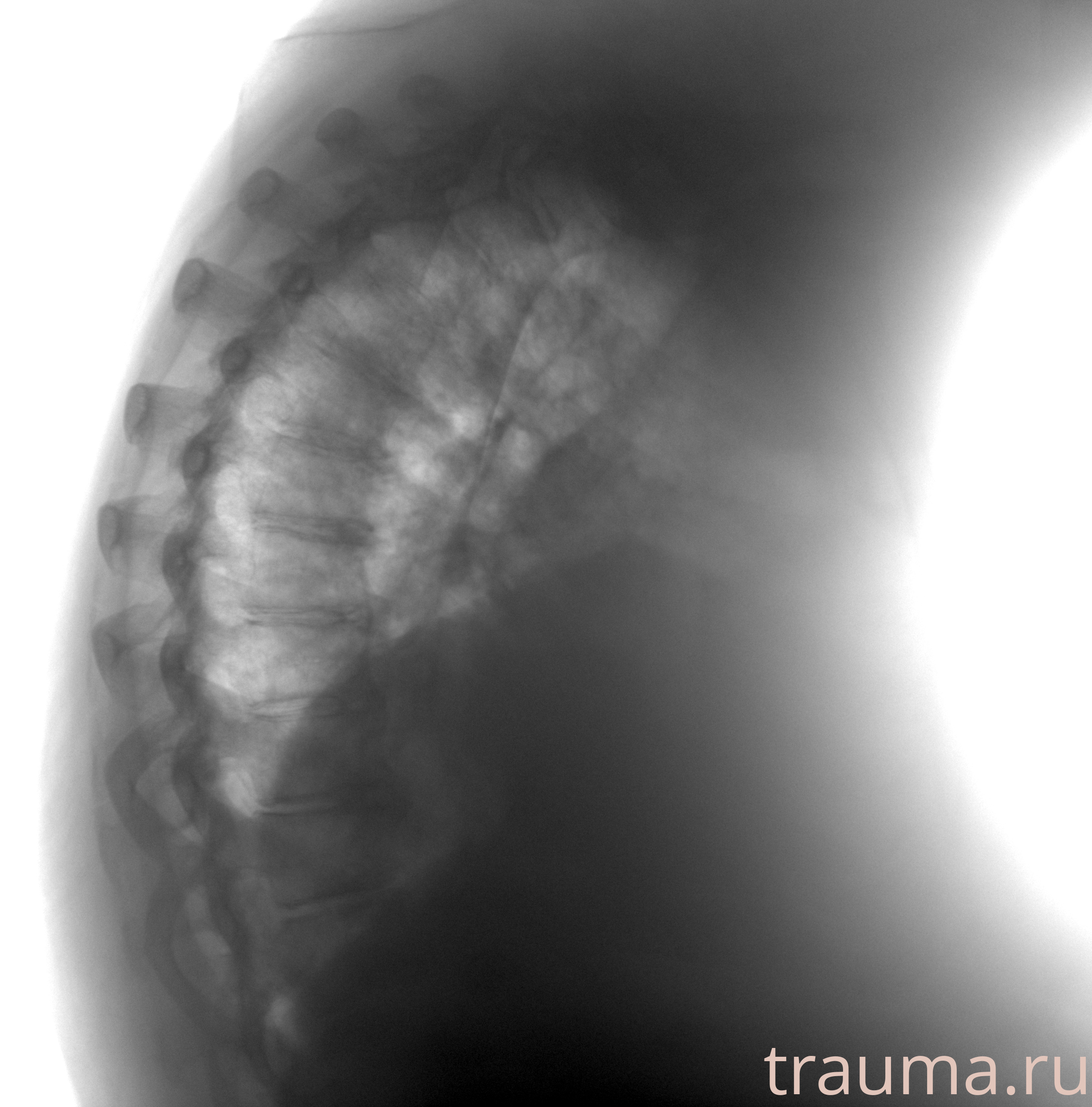 Рентген на дому: по вашему адресу приезжает врач-рентгенолог, травматолог-ортопед с мобильным рентгеновским аппаратом, проводит диагностику травмы или заболевания, делает необходимые рентгенограммы, дает рекомендации по дальнейшему лечению. Получить качественные снимки в домашних условиях возможно благодаря уникальной методике, разработанной МосРентген Центром для института  Склифосовского