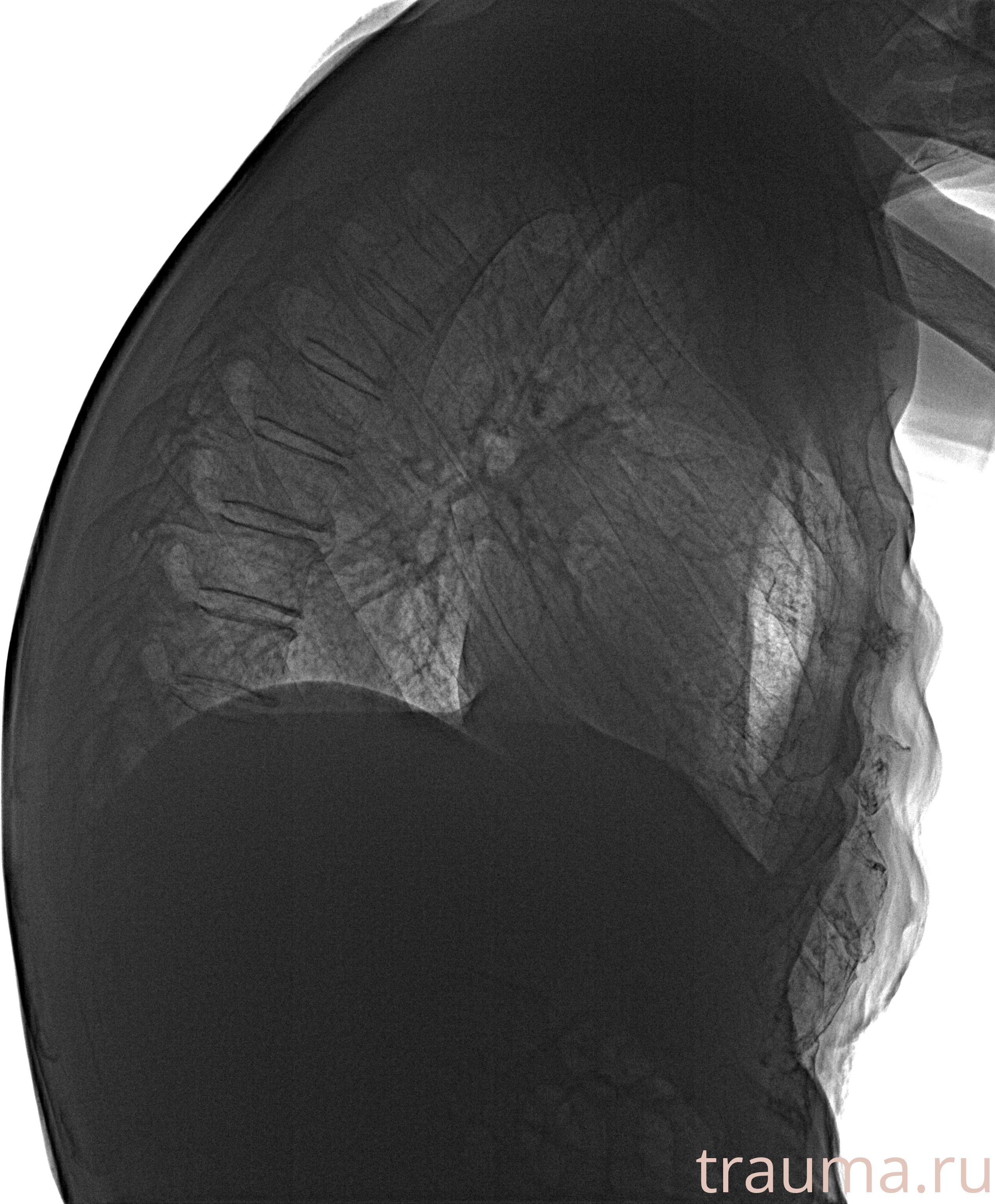 Рентген на дому: по вашему адресу приезжает врач-рентгенолог, травматолог-ортопед с мобильным рентгеновским аппаратом, проводит диагностику травмы или заболевания, делает необходимые рентгенограммы, дает рекомендации по дальнейшему лечению. Получить качественные снимки в домашних условиях возможно благодаря уникальной методике, разработанной МосРентген Центром для института  Склифосовского