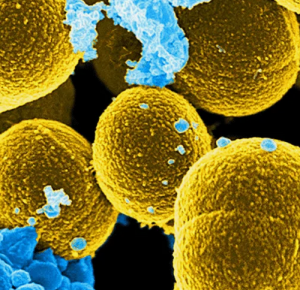 Сравнительная оценка коммерческих наборов бактериофагов и перспективы их применения для лечения пациентов с ортопедической MRSA-инфекцией