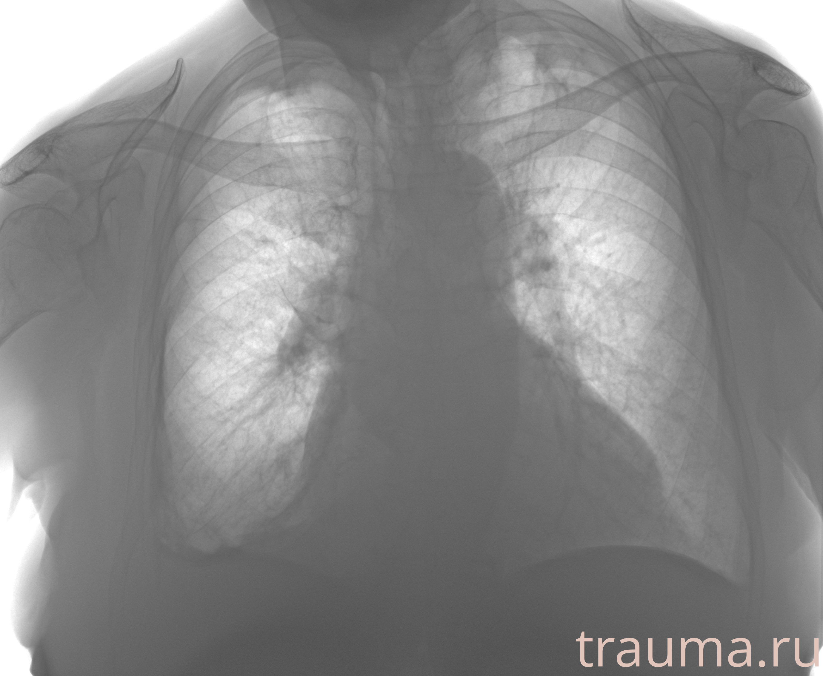 Рентген на дому: по вашему адресу приезжает врач-рентгенолог, травматолог-ортопед с мобильным рентгеновским аппаратом, проводит диагностику травмы или заболевания, делает необходимые рентгенограммы, дает рекомендации по дальнейшему лечению. Получить качественные снимки в домашних условиях возможно благодаря уникальной методике, разработанной МосРентген Центром для института  Склифосовского