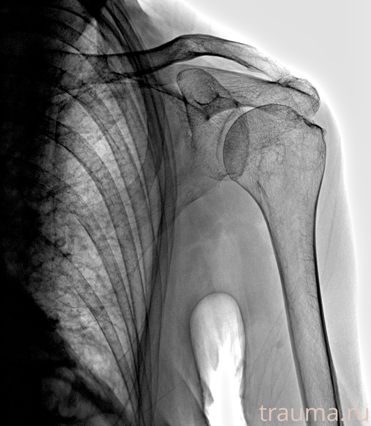 Рентген на дому: по вашему адресу приезжает врач-рентгенолог, травматолог-ортопед с мобильным рентгеновским аппаратом, проводит диагностику травмы или заболевания, делает необходимые рентгенограммы, дает рекомендации по дальнейшему лечению. Получить качественные снимки в домашних условиях возможно благодаря уникальной методике, разработанной МосРентген Центром для института  Склифосовского