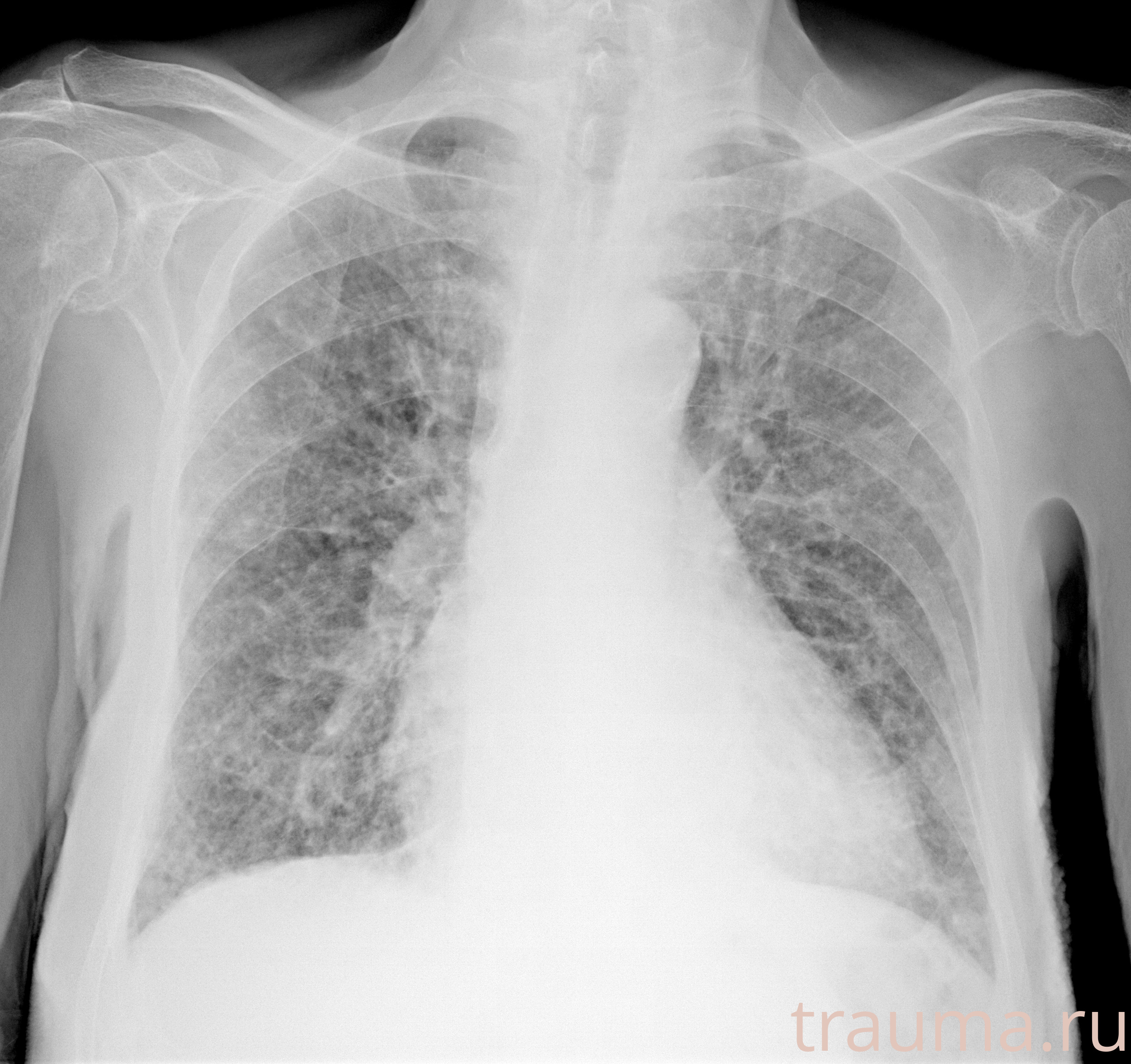 Рентген на дому: по вашему адресу приезжает врач-рентгенолог, травматолог-ортопед с мобильным рентгеновским аппаратом, проводит диагностику травмы или заболевания, делает необходимые рентгенограммы, дает рекомендации по дальнейшему лечению. Получить качественные снимки в домашних условиях возможно благодаря уникальной методике, разработанной МосРентген Центром для института  Склифосовского