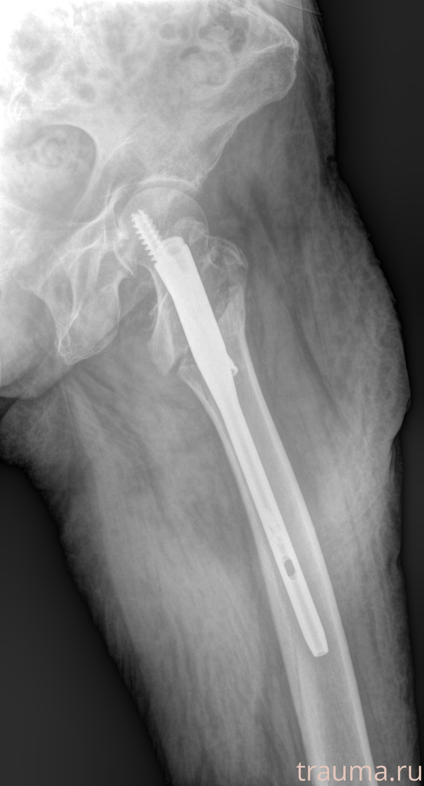 Рентген на дому: по вашему адресу приезжает врач-рентгенолог, травматолог-ортопед с мобильным рентгеновским аппаратом, проводит диагностику травмы или заболевания, делает необходимые рентгенограммы, дает рекомендации по дальнейшему лечению. Получить качественные снимки в домашних условиях возможно благодаря уникальной методике, разработанной МосРентген Центром для института  Склифосовского