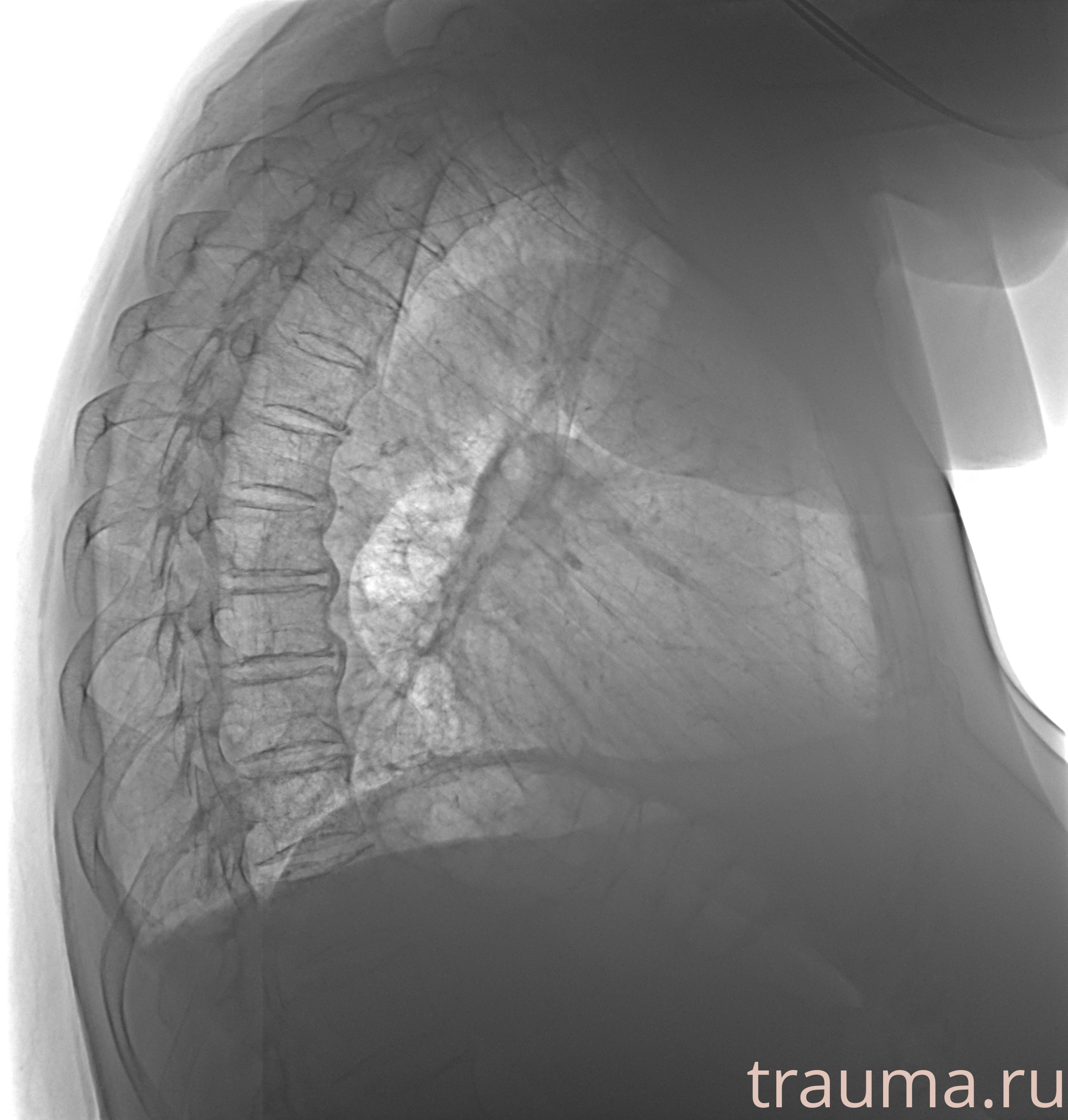 Рентген на дому: по вашему адресу приезжает врач-рентгенолог, травматолог-ортопед с мобильным рентгеновским аппаратом, проводит диагностику травмы или заболевания, делает необходимые рентгенограммы, дает рекомендации по дальнейшему лечению. Получить качественные снимки в домашних условиях возможно благодаря уникальной методике, разработанной МосРентген Центром для института  Склифосовского