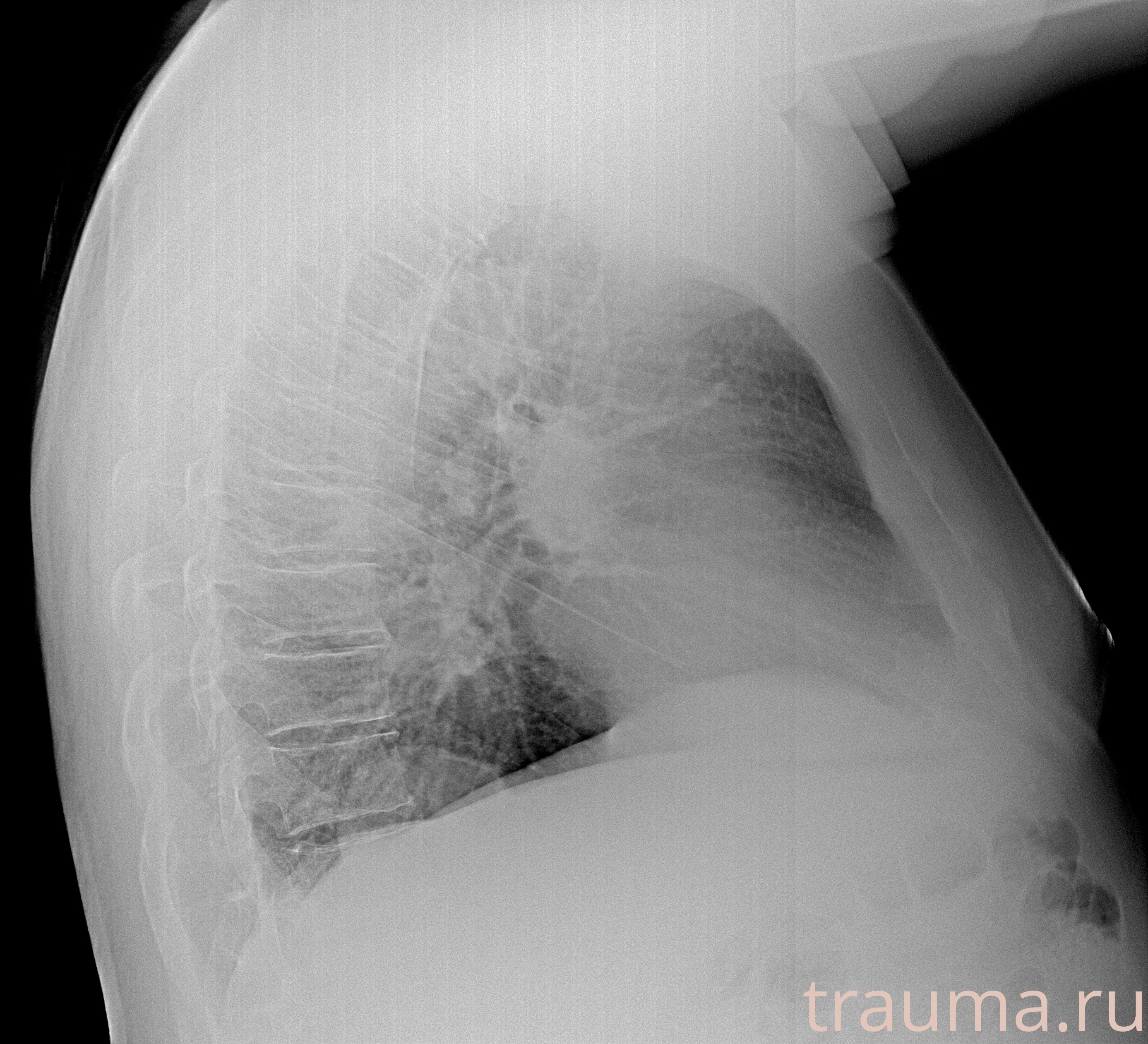 Рентген на дому: по вашему адресу приезжает врач-рентгенолог, травматолог-ортопед с мобильным рентгеновским аппаратом, проводит диагностику травмы или заболевания, делает необходимые рентгенограммы, дает рекомендации по дальнейшему лечению. Получить качественные снимки в домашних условиях возможно благодаря уникальной методике, разработанной МосРентген Центром для института  Склифосовского