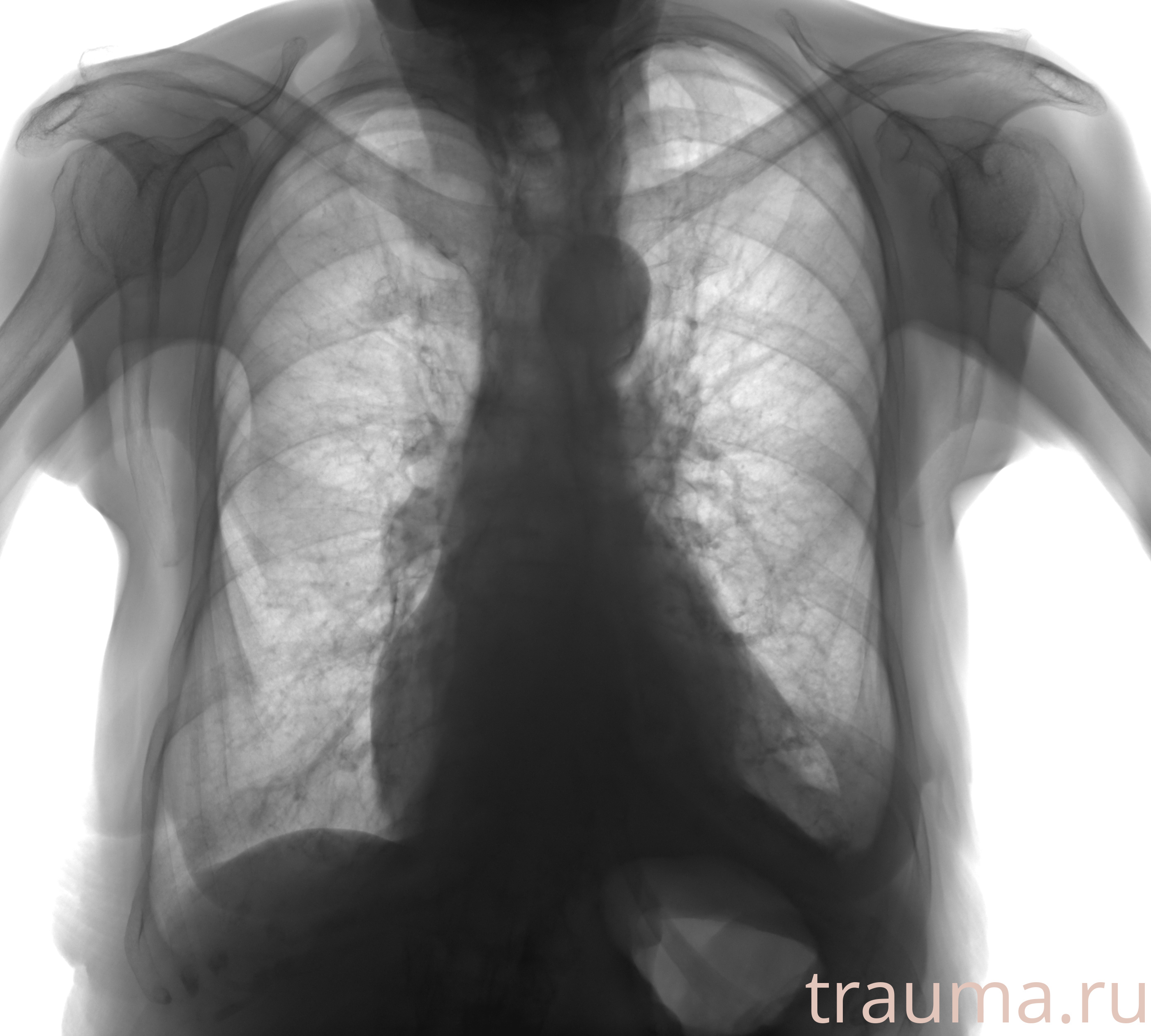 Рентген на дому: по вашему адресу приезжает врач-рентгенолог, травматолог-ортопед с мобильным рентгеновским аппаратом, проводит диагностику травмы или заболевания, делает необходимые рентгенограммы, дает рекомендации по дальнейшему лечению. Получить качественные снимки в домашних условиях возможно благодаря уникальной методике, разработанной МосРентген Центром для института  Склифосовского