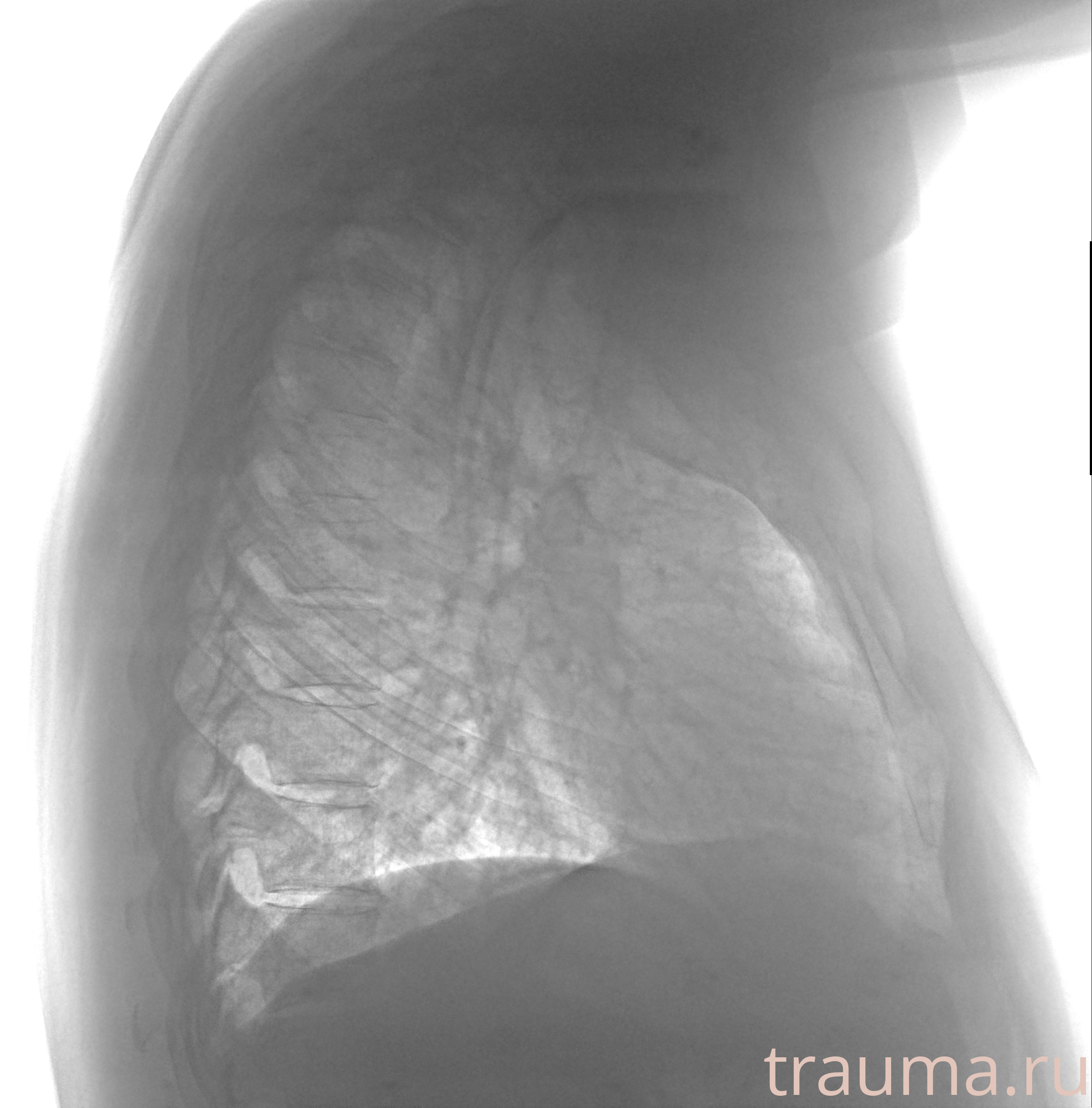 Рентген на дому: по вашему адресу приезжает врач-рентгенолог, травматолог-ортопед с мобильным рентгеновским аппаратом, проводит диагностику травмы или заболевания, делает необходимые рентгенограммы, дает рекомендации по дальнейшему лечению. Получить качественные снимки в домашних условиях возможно благодаря уникальной методике, разработанной МосРентген Центром для института  Склифосовского