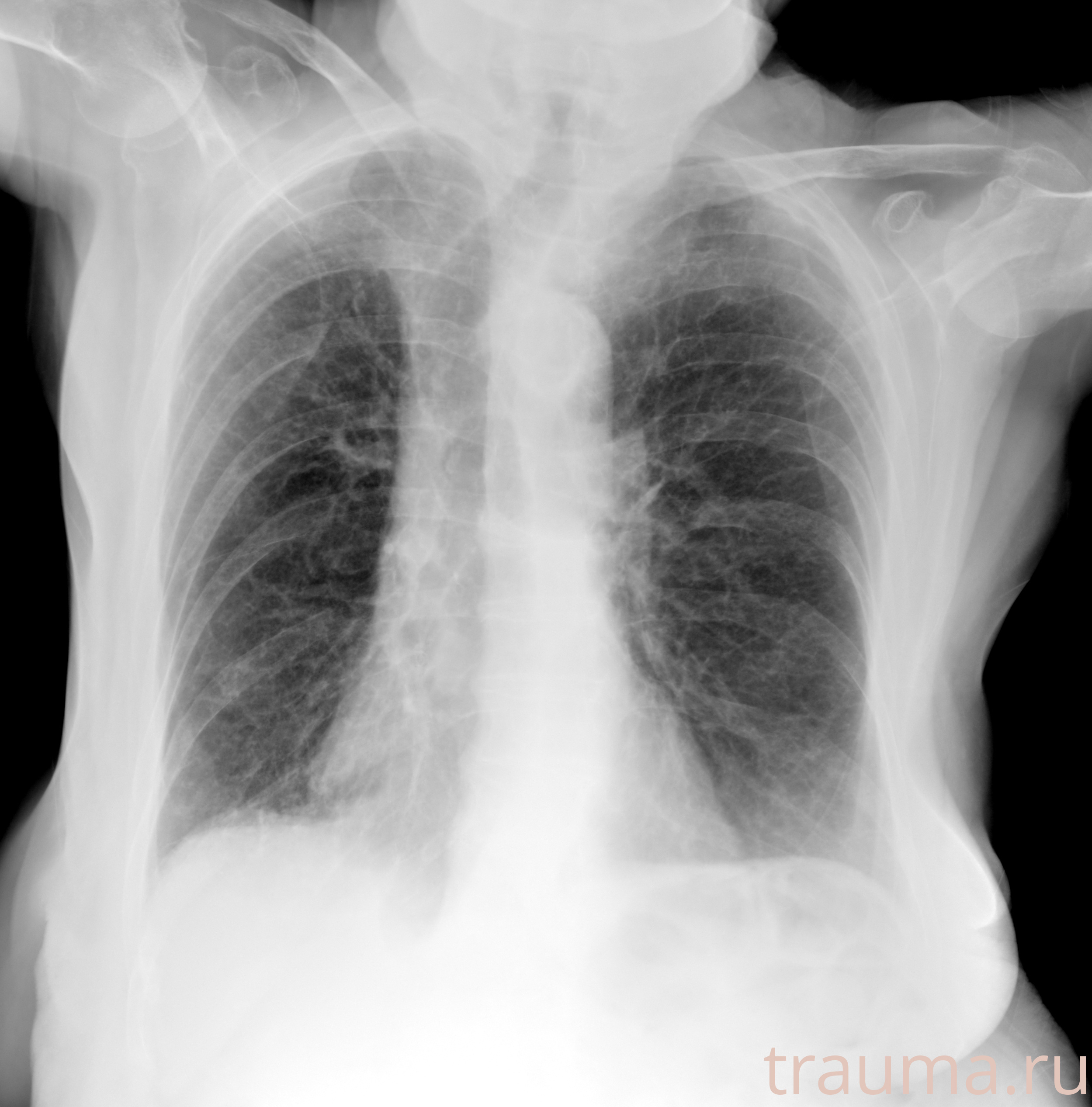 Рентген на дому: по вашему адресу приезжает врач-рентгенолог, травматолог-ортопед с мобильным рентгеновским аппаратом, проводит диагностику травмы или заболевания, делает необходимые рентгенограммы, дает рекомендации по дальнейшему лечению. Получить качественные снимки в домашних условиях возможно благодаря уникальной методике, разработанной МосРентген Центром для института  Склифосовского