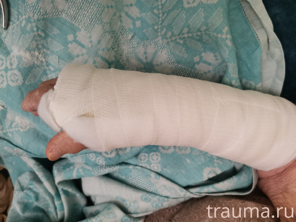 Рентген на дому: по вашему адресу приезжает врач-рентгенолог, травматолог-ортопед с мобильным рентгеновским аппаратом, проводит диагностику травмы или заболевания, делает необходимые рентгенограммы, дает рекомендации по дальнейшему лечению. Получить качественные снимки в домашних условиях возможно благодаря уникальной методике, разработанной МосРентген Центром для института  Склифосовского