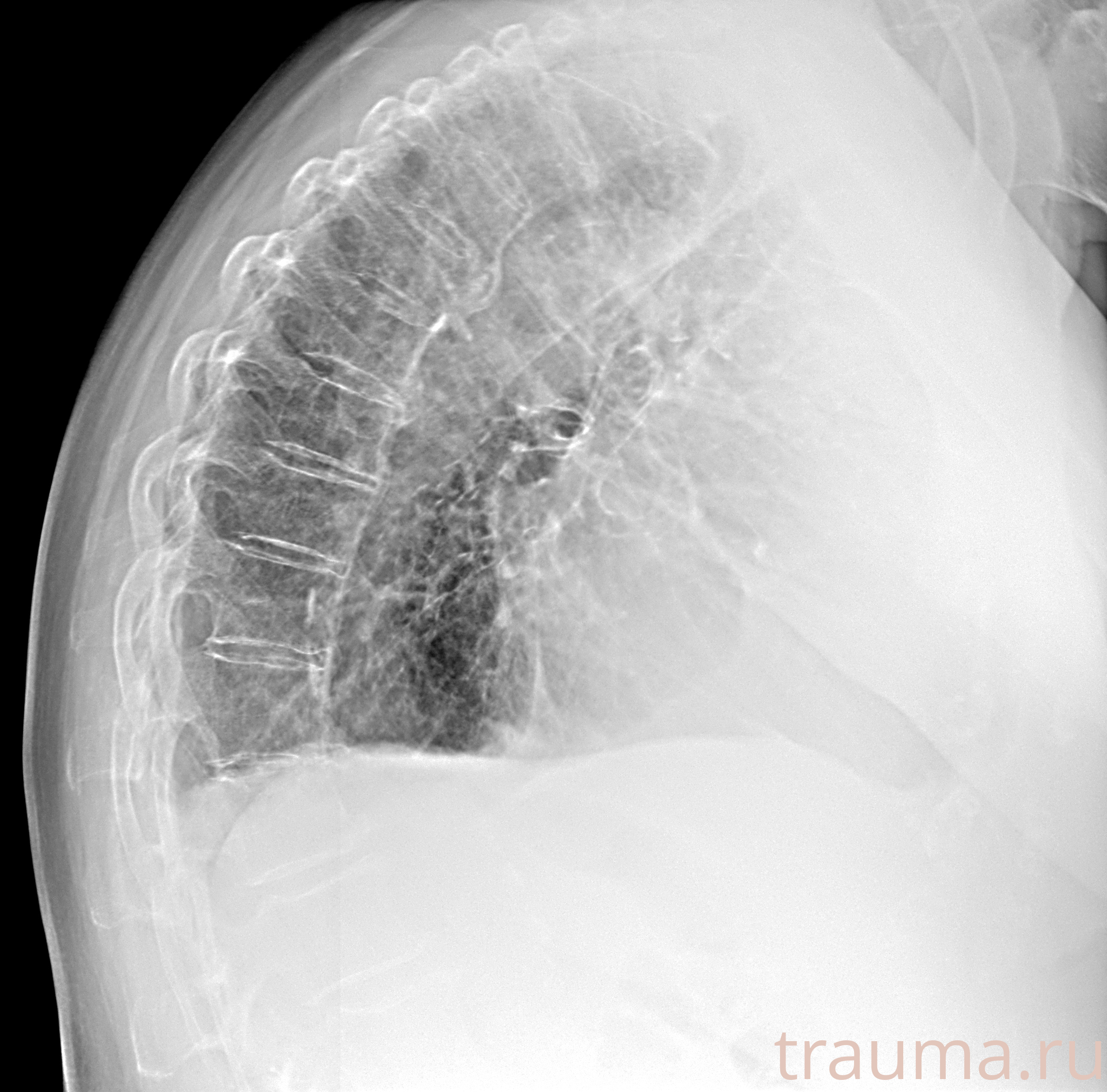 Рентген на дому: по вашему адресу приезжает врач-рентгенолог, травматолог-ортопед с мобильным рентгеновским аппаратом, проводит диагностику травмы или заболевания, делает необходимые рентгенограммы, дает рекомендации по дальнейшему лечению. Получить качественные снимки в домашних условиях возможно благодаря уникальной методике, разработанной МосРентген Центром для института  Склифосовского