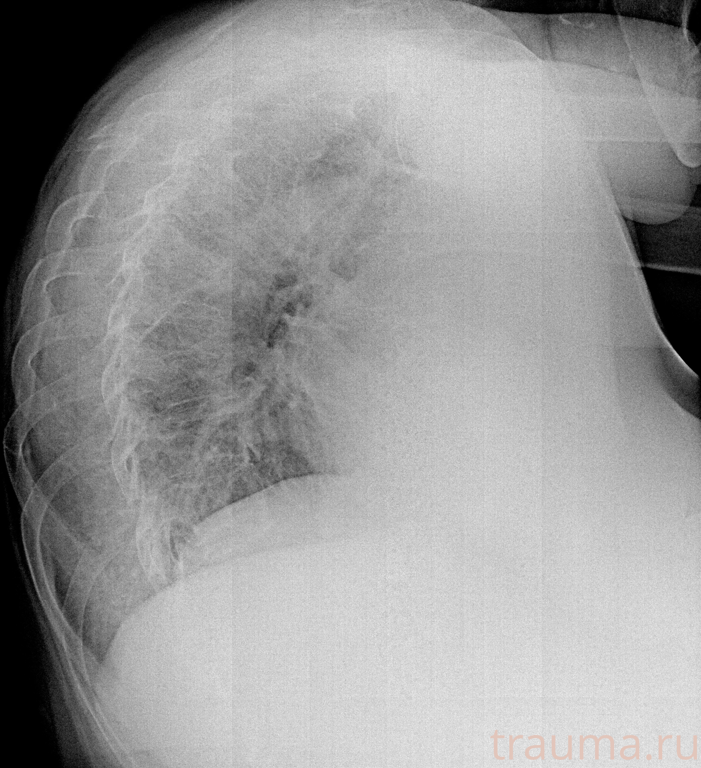 Рентген на дому: по вашему адресу приезжает врач-рентгенолог, травматолог-ортопед с мобильным рентгеновским аппаратом, проводит диагностику травмы или заболевания, делает необходимые рентгенограммы, дает рекомендации по дальнейшему лечению. Получить качественные снимки в домашних условиях возможно благодаря уникальной методике, разработанной МосРентген Центром для института  Склифосовского