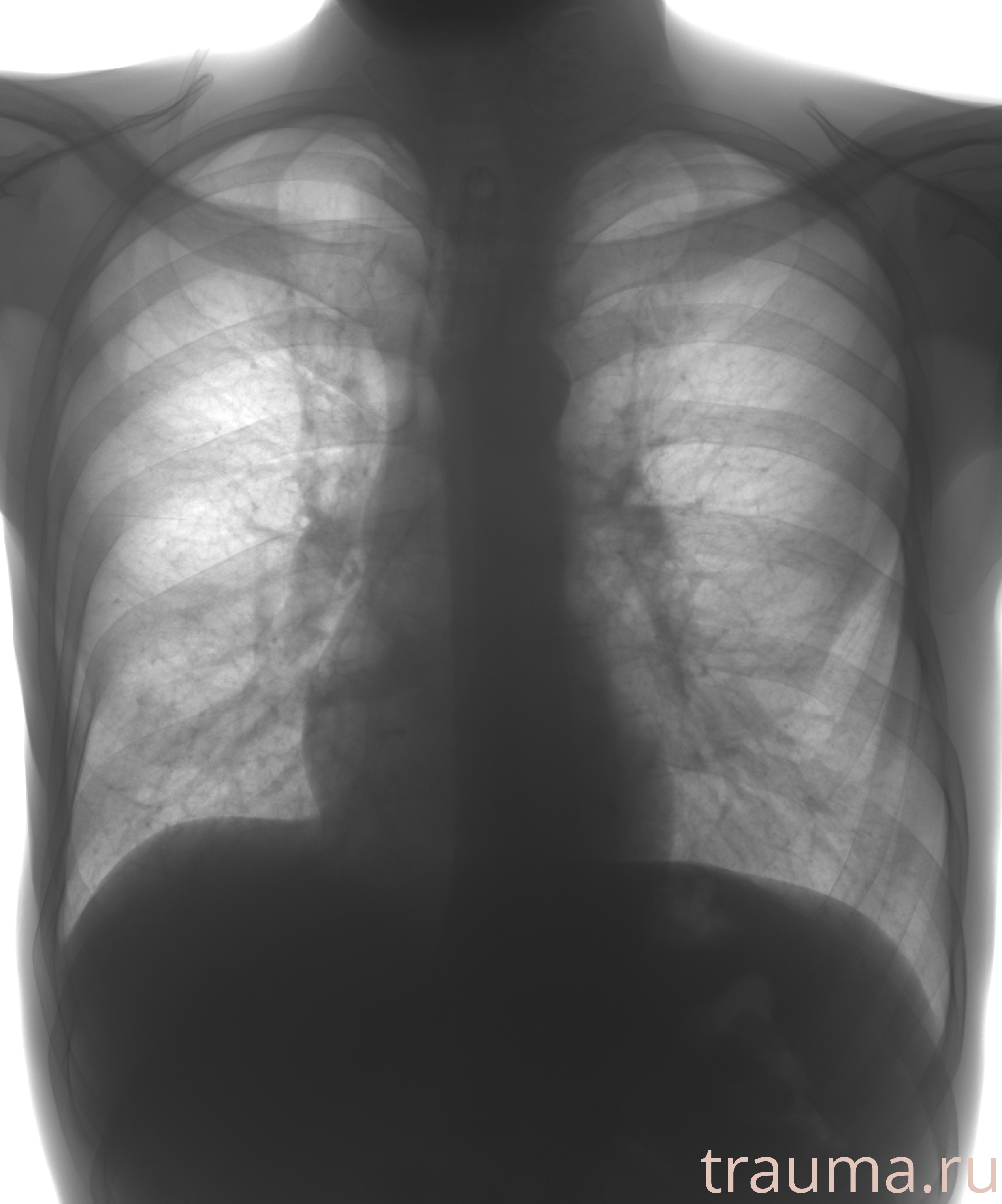 Рентген на дому: по вашему адресу приезжает врач-рентгенолог, травматолог-ортопед с мобильным рентгеновским аппаратом, проводит диагностику травмы или заболевания, делает необходимые рентгенограммы, дает рекомендации по дальнейшему лечению. Получить качественные снимки в домашних условиях возможно благодаря уникальной методике, разработанной МосРентген Центром для института  Склифосовского