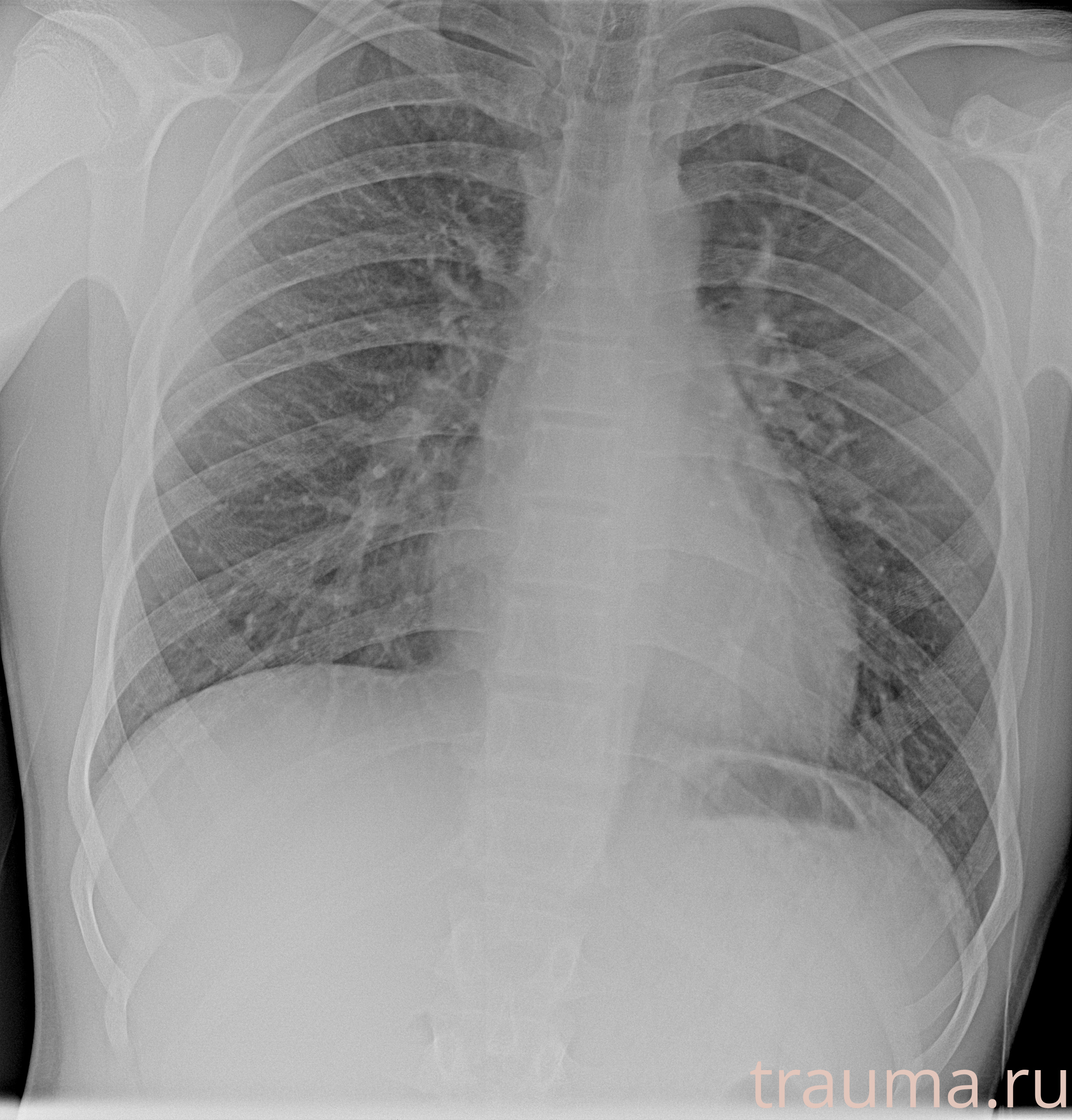 Рентген на дому: по вашему адресу приезжает врач-рентгенолог, травматолог-ортопед с мобильным рентгеновским аппаратом, проводит диагностику травмы или заболевания, делает необходимые рентгенограммы, дает рекомендации по дальнейшему лечению. Получить качественные снимки в домашних условиях возможно благодаря уникальной методике, разработанной МосРентген Центром для института  Склифосовского