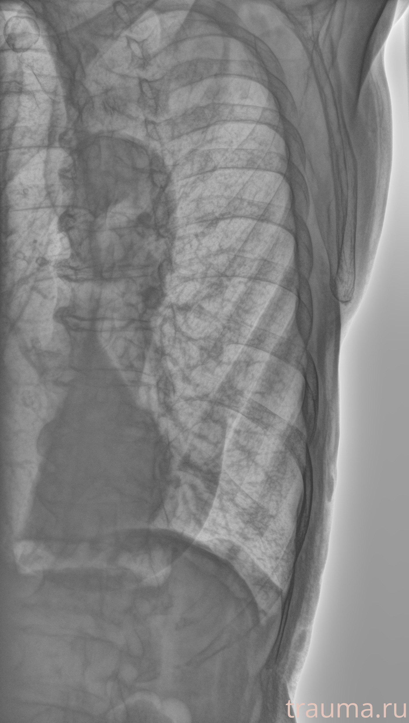 Рентген на дому: по вашему адресу приезжает врач-рентгенолог, травматолог-ортопед с мобильным рентгеновским аппаратом, проводит диагностику травмы или заболевания, делает необходимые рентгенограммы, дает рекомендации по дальнейшему лечению. Получить качественные снимки в домашних условиях возможно благодаря уникальной методике, разработанной МосРентген Центром для института  Склифосовского