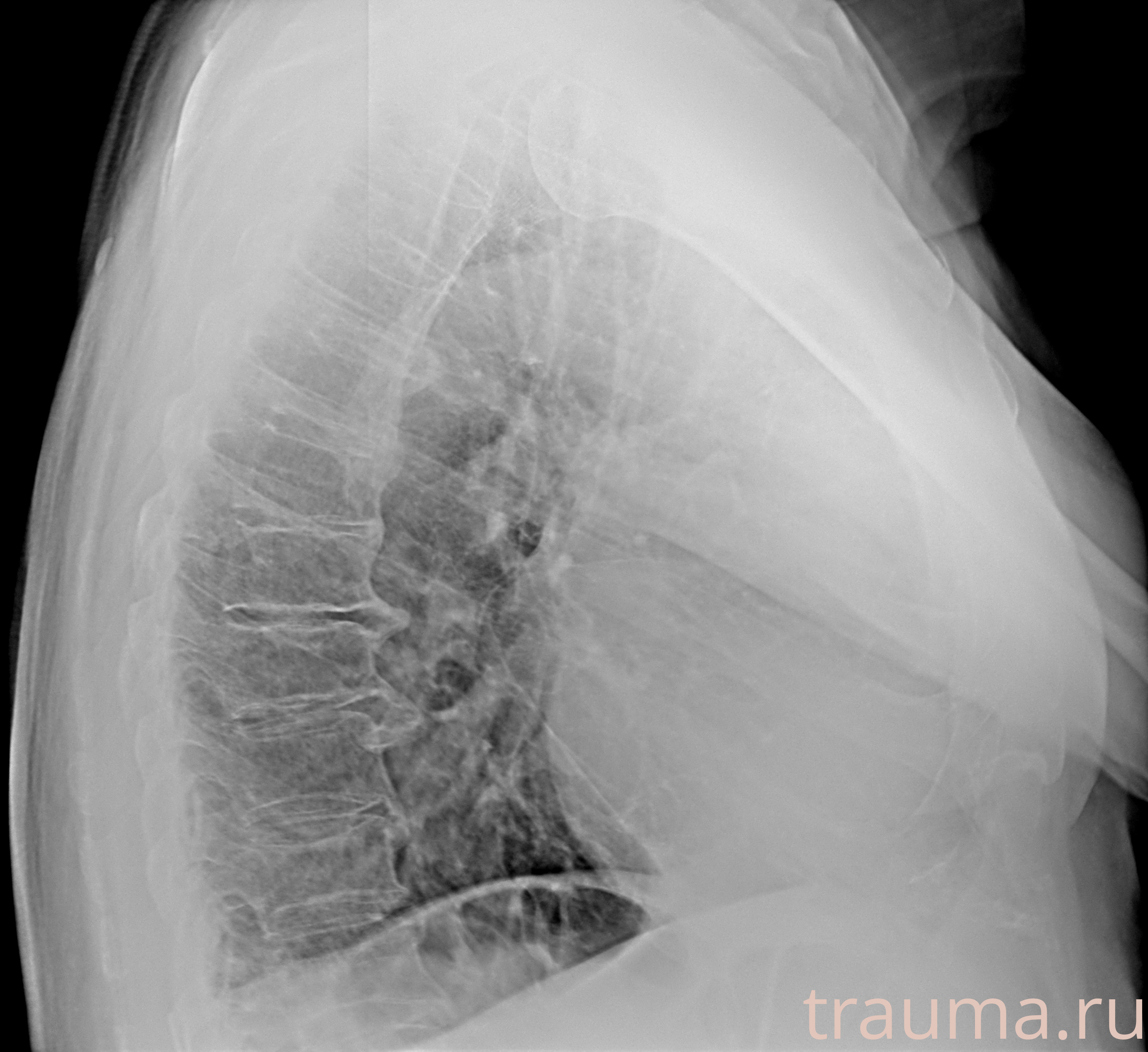 Рентген на дому: по вашему адресу приезжает врач-рентгенолог, травматолог-ортопед с мобильным рентгеновским аппаратом, проводит диагностику травмы или заболевания, делает необходимые рентгенограммы, дает рекомендации по дальнейшему лечению. Получить качественные снимки в домашних условиях возможно благодаря уникальной методике, разработанной МосРентген Центром для института  Склифосовского