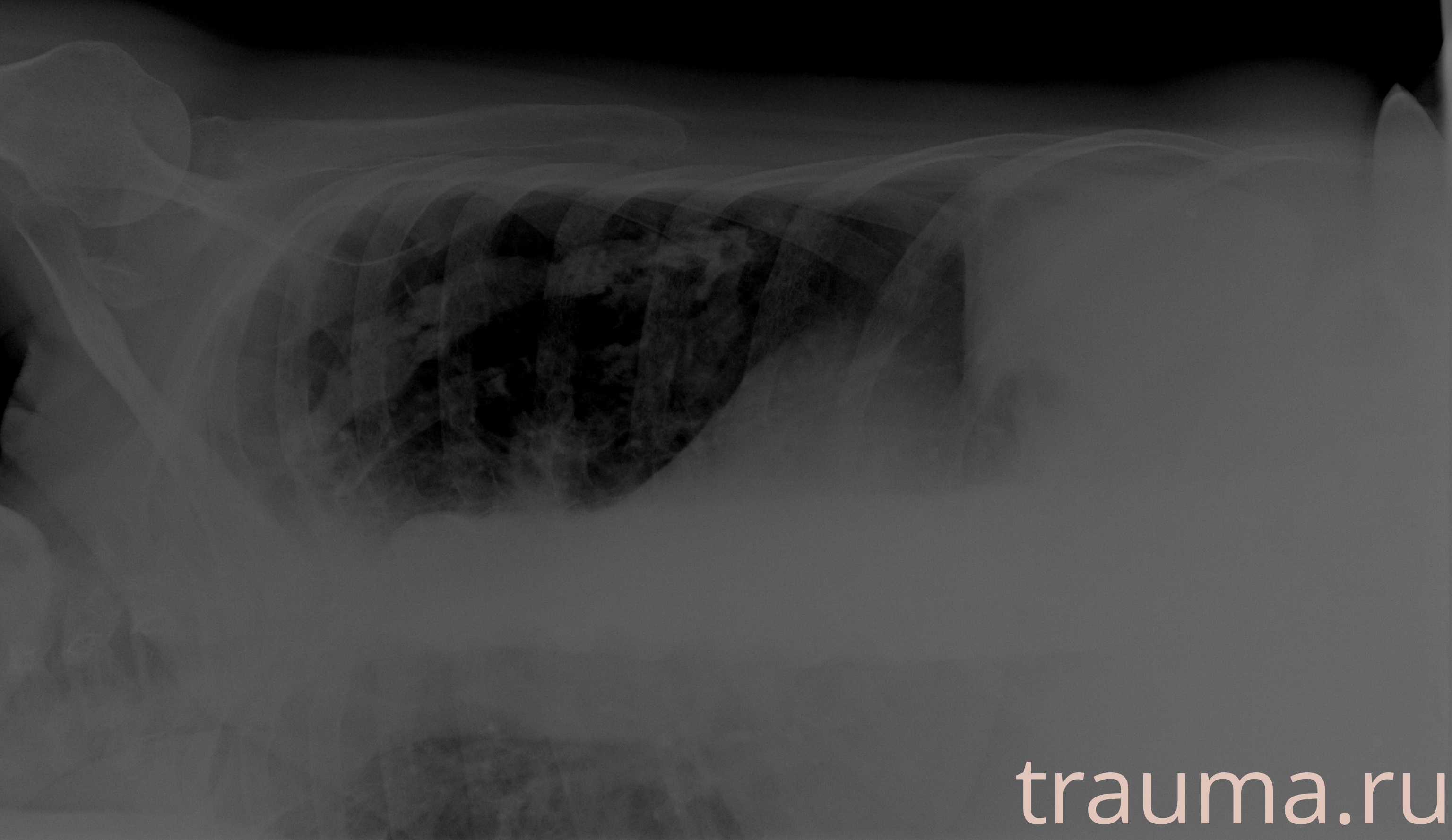 Рентген на дому: по вашему адресу приезжает врач-рентгенолог, травматолог-ортопед с мобильным рентгеновским аппаратом, проводит диагностику травмы или заболевания, делает необходимые рентгенограммы, дает рекомендации по дальнейшему лечению. Получить качественные снимки в домашних условиях возможно благодаря уникальной методике, разработанной МосРентген Центром для института  Склифосовского