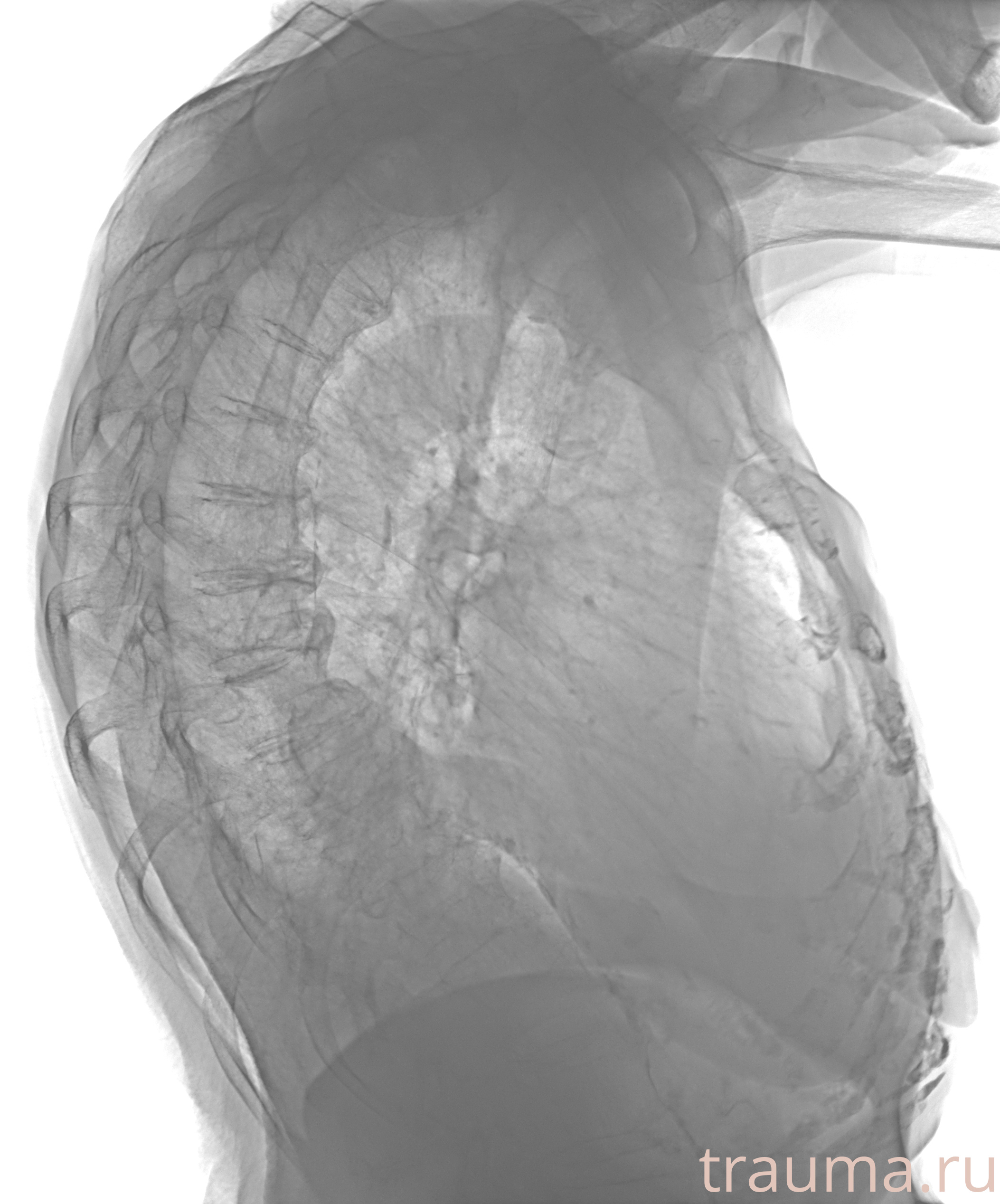 Рентген на дому: по вашему адресу приезжает врач-рентгенолог, травматолог-ортопед с мобильным рентгеновским аппаратом, проводит диагностику травмы или заболевания, делает необходимые рентгенограммы, дает рекомендации по дальнейшему лечению. Получить качественные снимки в домашних условиях возможно благодаря уникальной методике, разработанной МосРентген Центром для института  Склифосовского