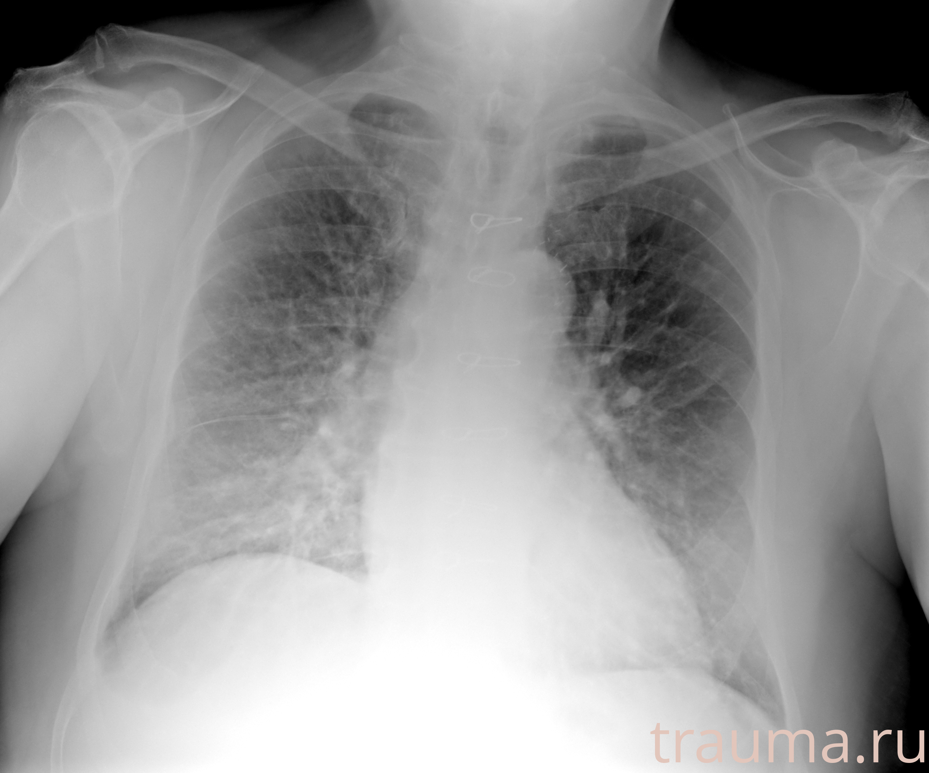 Рентген на дому: по вашему адресу приезжает врач-рентгенолог, травматолог-ортопед с мобильным рентгеновским аппаратом, проводит диагностику травмы или заболевания, делает необходимые рентгенограммы, дает рекомендации по дальнейшему лечению. Получить качественные снимки в домашних условиях возможно благодаря уникальной методике, разработанной МосРентген Центром для института  Склифосовского