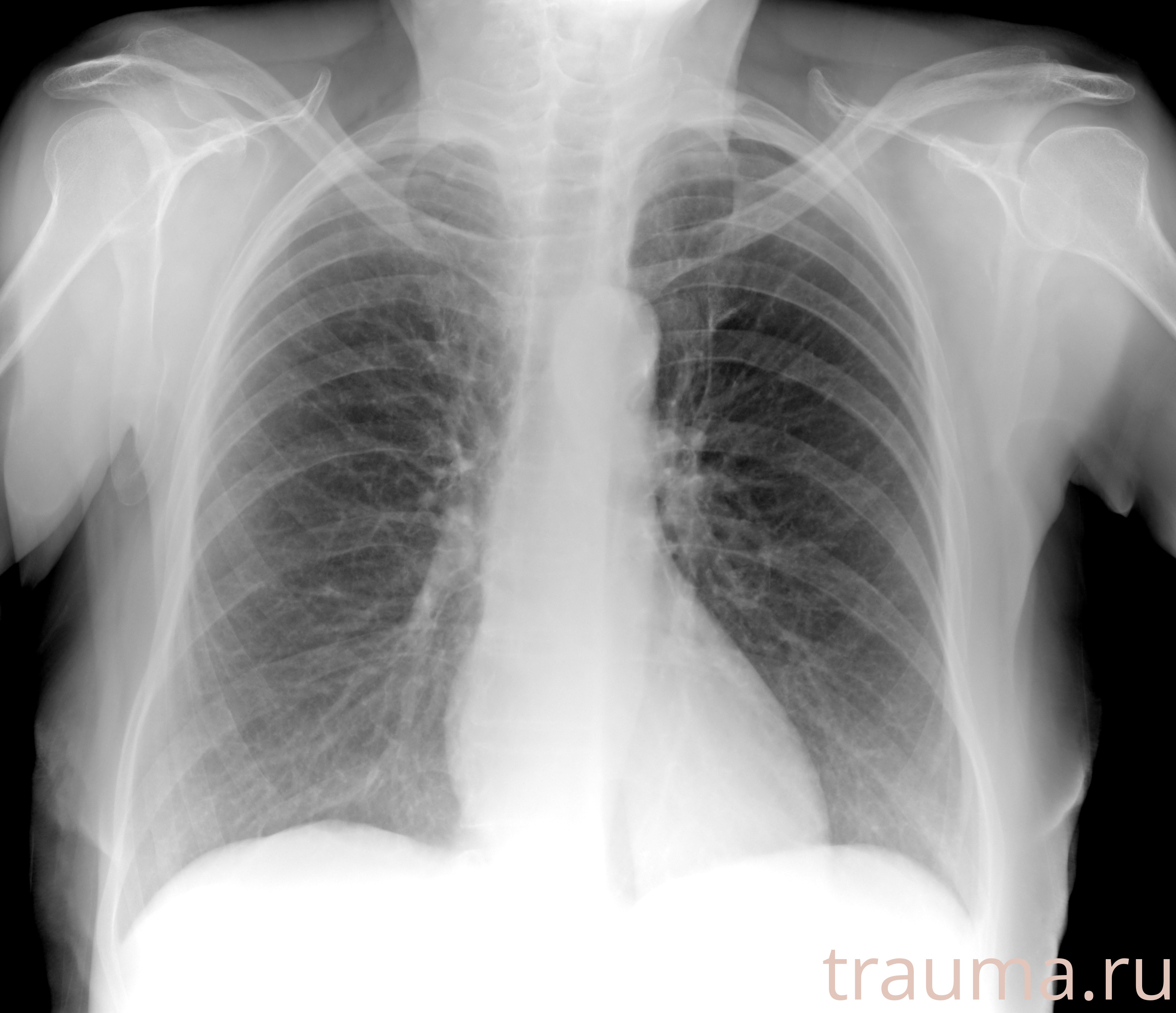 Рентген на дому: по вашему адресу приезжает врач-рентгенолог, травматолог-ортопед с мобильным рентгеновским аппаратом, проводит диагностику травмы или заболевания, делает необходимые рентгенограммы, дает рекомендации по дальнейшему лечению. Получить качественные снимки в домашних условиях возможно благодаря уникальной методике, разработанной МосРентген Центром для института  Склифосовского