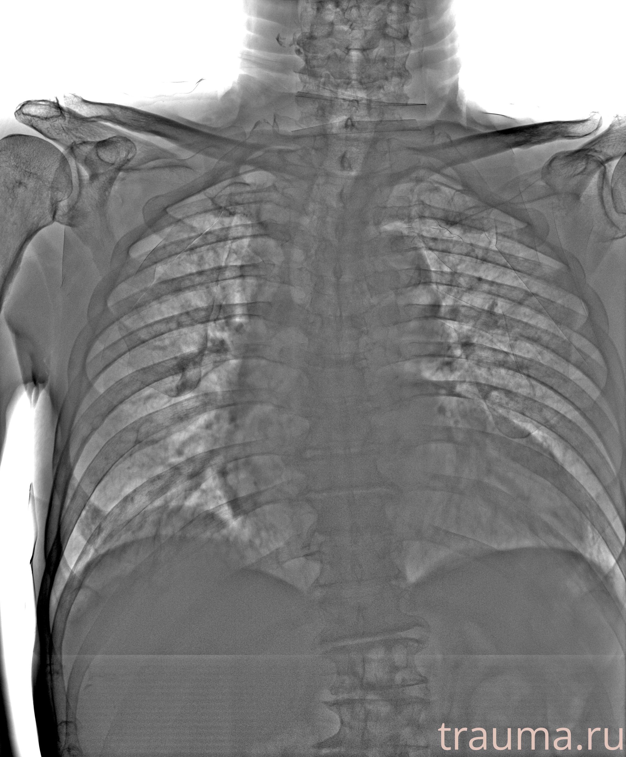 Рентген на дому: по вашему адресу приезжает врач-рентгенолог, травматолог-ортопед с мобильным рентгеновским аппаратом, проводит диагностику травмы или заболевания, делает необходимые рентгенограммы, дает рекомендации по дальнейшему лечению. Получить качественные снимки в домашних условиях возможно благодаря уникальной методике, разработанной МосРентген Центром для института  Склифосовского