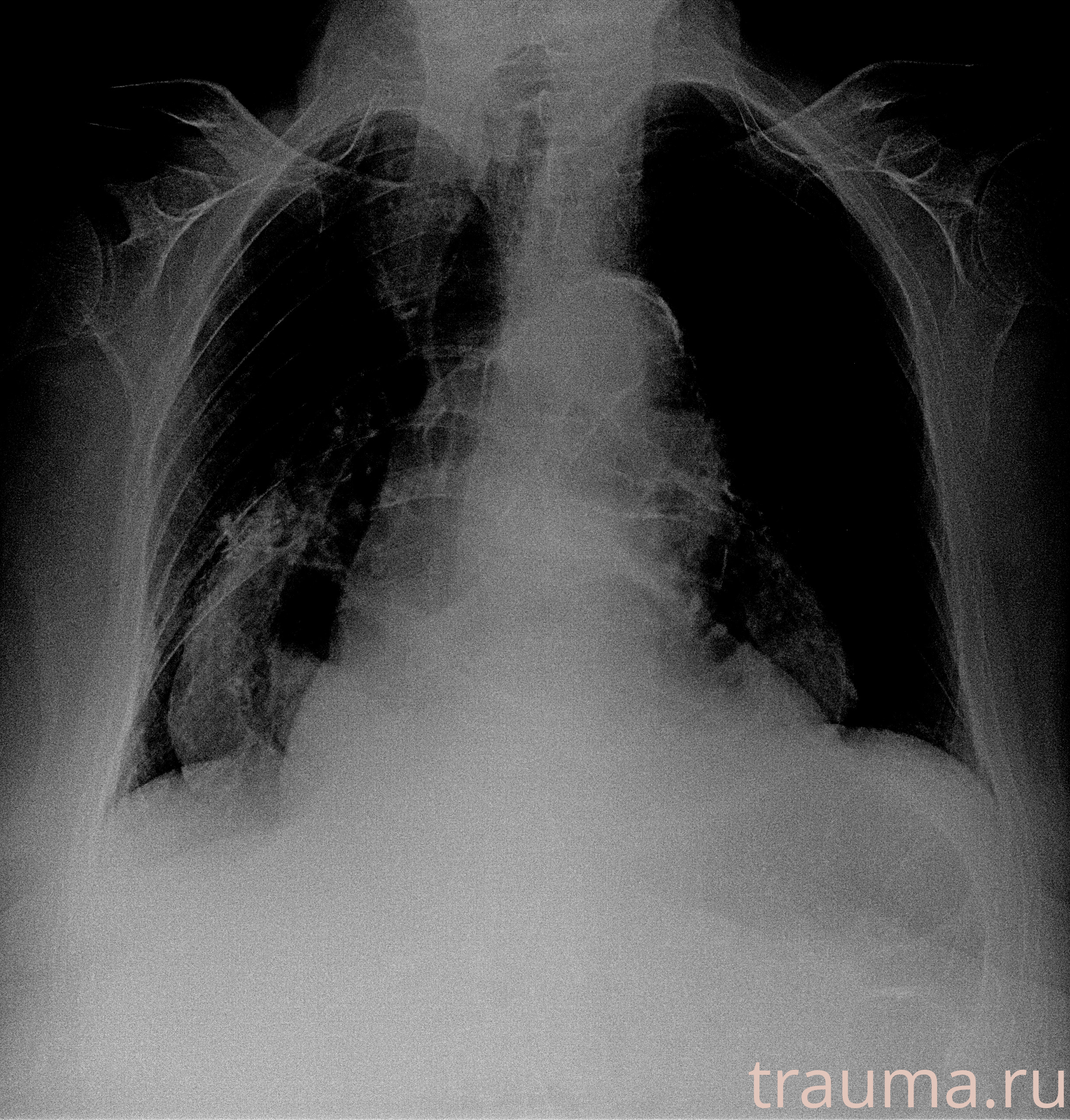 Рентген на дому: по вашему адресу приезжает врач-рентгенолог, травматолог-ортопед с мобильным рентгеновским аппаратом, проводит диагностику травмы или заболевания, делает необходимые рентгенограммы, дает рекомендации по дальнейшему лечению. Получить качественные снимки в домашних условиях возможно благодаря уникальной методике, разработанной МосРентген Центром для института  Склифосовского
