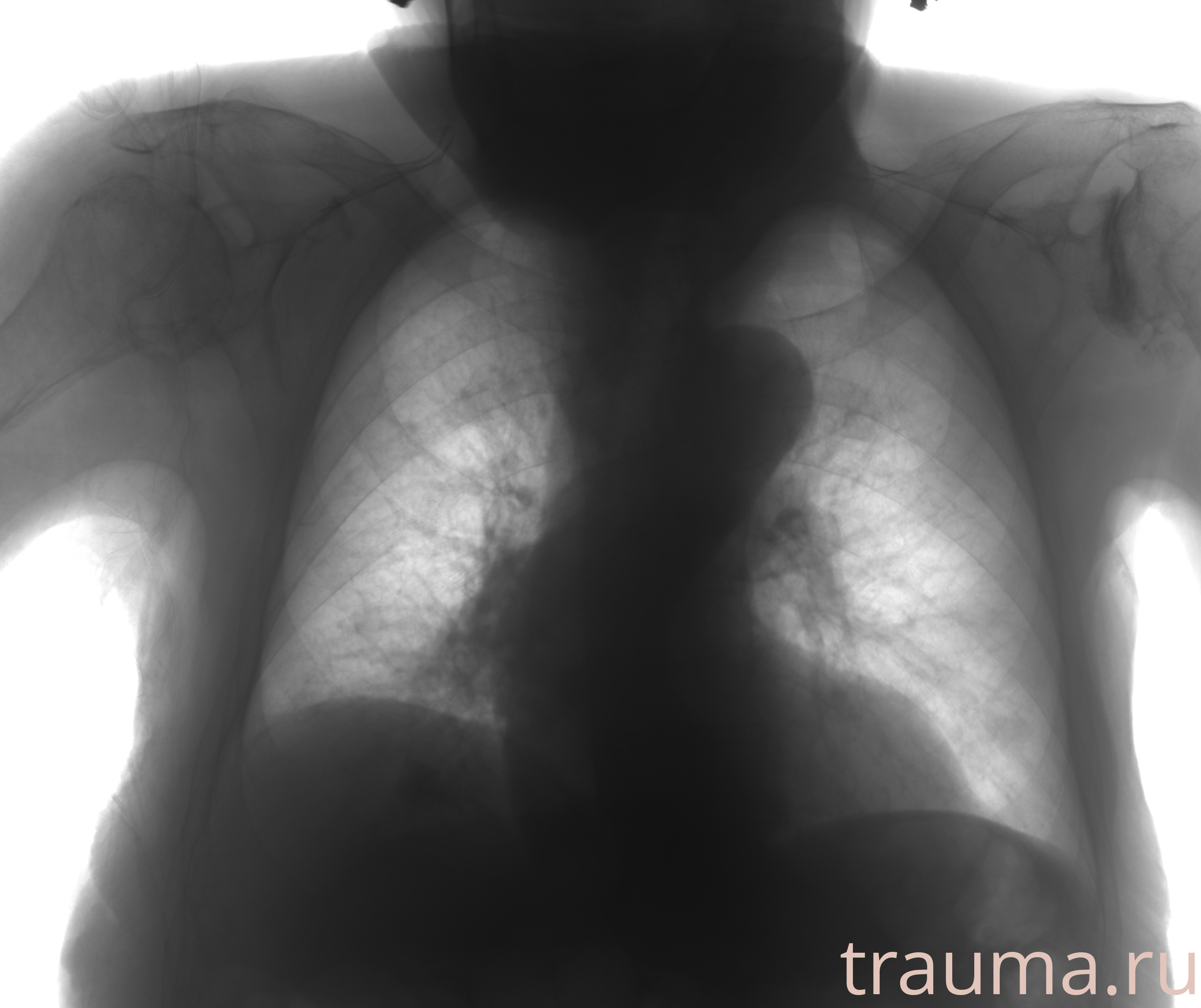 Рентген на дому: по вашему адресу приезжает врач-рентгенолог, травматолог-ортопед с мобильным рентгеновским аппаратом, проводит диагностику травмы или заболевания, делает необходимые рентгенограммы, дает рекомендации по дальнейшему лечению. Получить качественные снимки в домашних условиях возможно благодаря уникальной методике, разработанной МосРентген Центром для института  Склифосовского