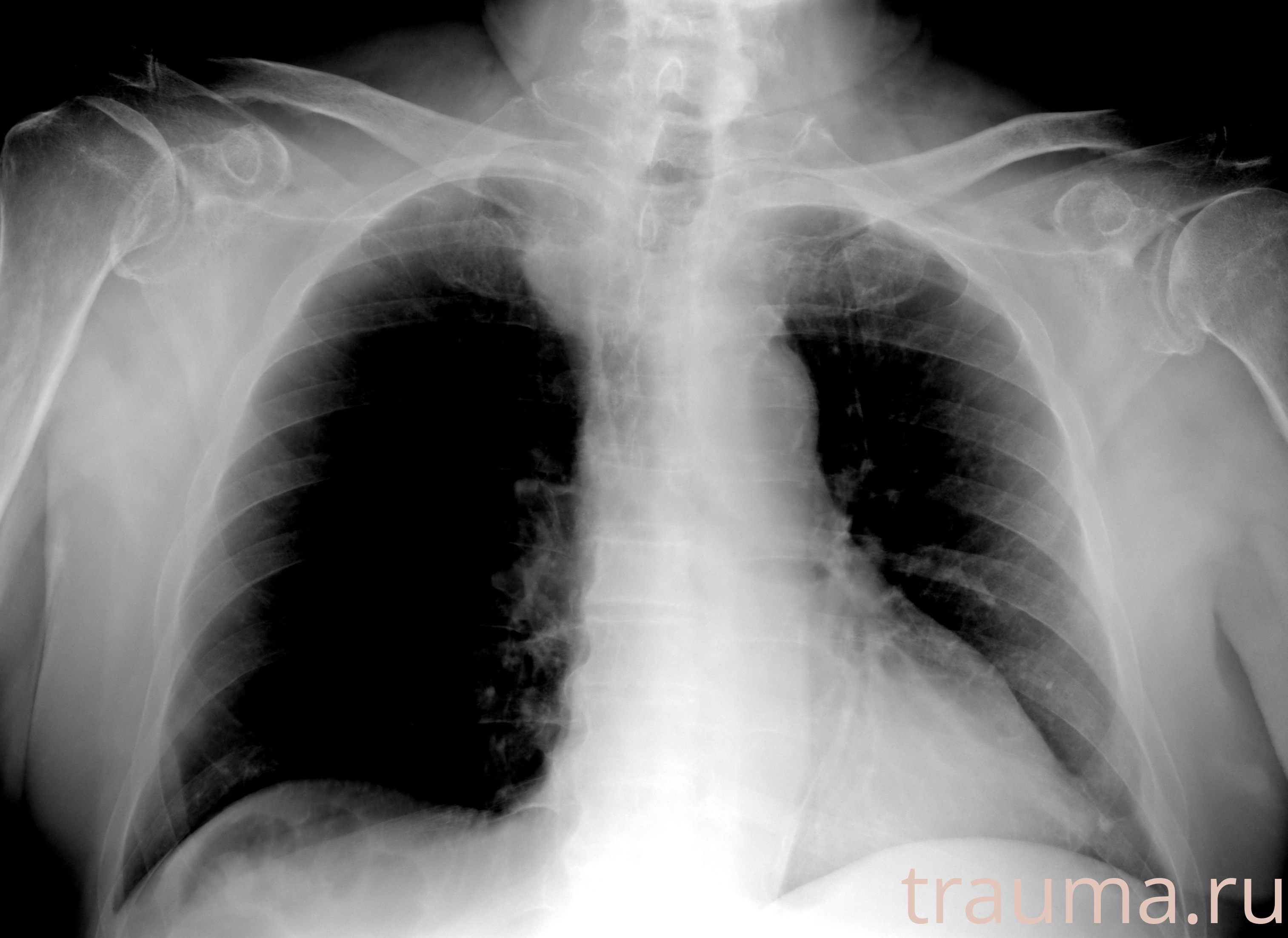 Рентген на дому: по вашему адресу приезжает врач-рентгенолог, травматолог-ортопед с мобильным рентгеновским аппаратом, проводит диагностику травмы или заболевания, делает необходимые рентгенограммы, дает рекомендации по дальнейшему лечению. Получить качественные снимки в домашних условиях возможно благодаря уникальной методике, разработанной МосРентген Центром для института  Склифосовского