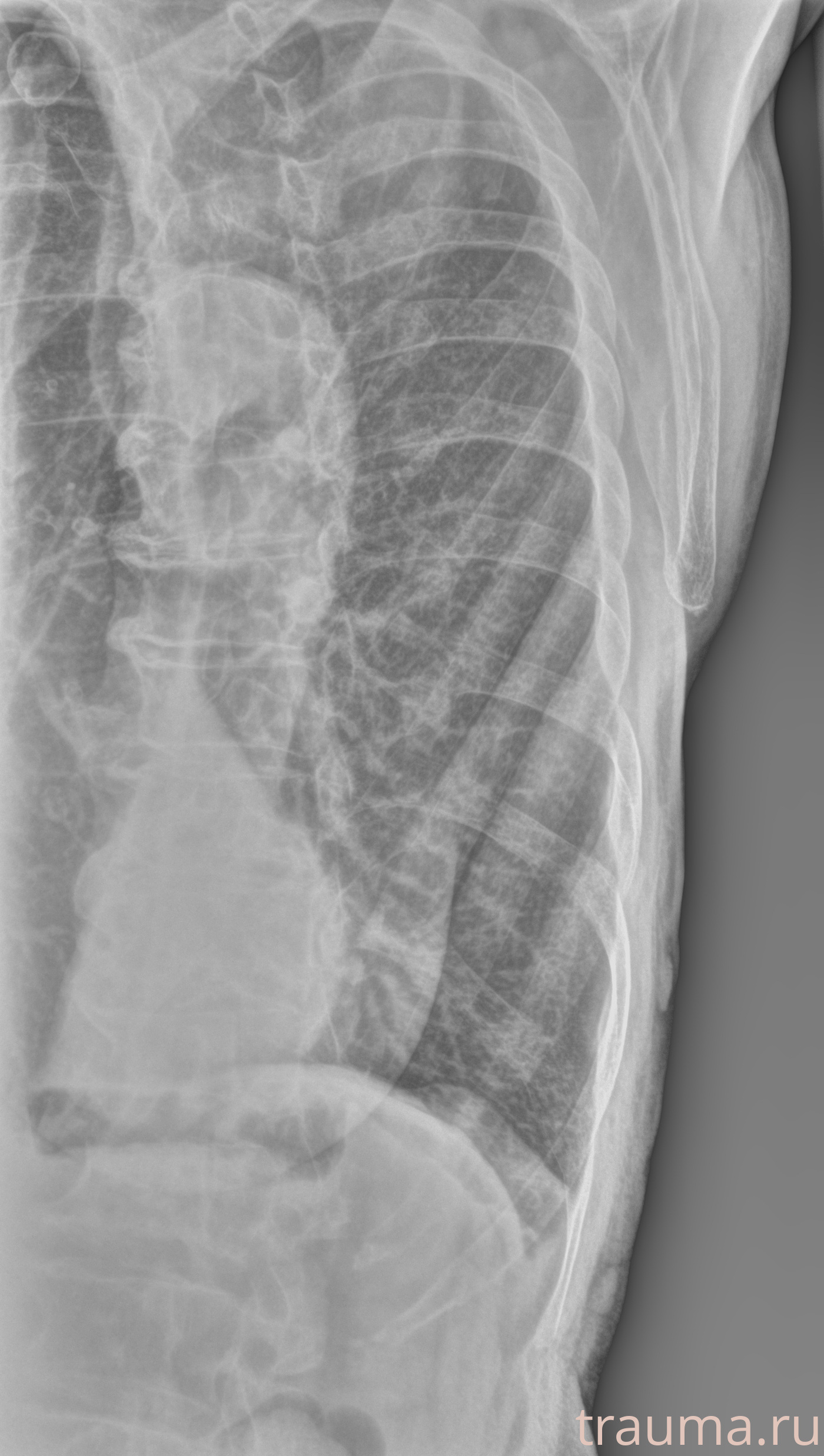 Рентген на дому: по вашему адресу приезжает врач-рентгенолог, травматолог-ортопед с мобильным рентгеновским аппаратом, проводит диагностику травмы или заболевания, делает необходимые рентгенограммы, дает рекомендации по дальнейшему лечению. Получить качественные снимки в домашних условиях возможно благодаря уникальной методике, разработанной МосРентген Центром для института  Склифосовского