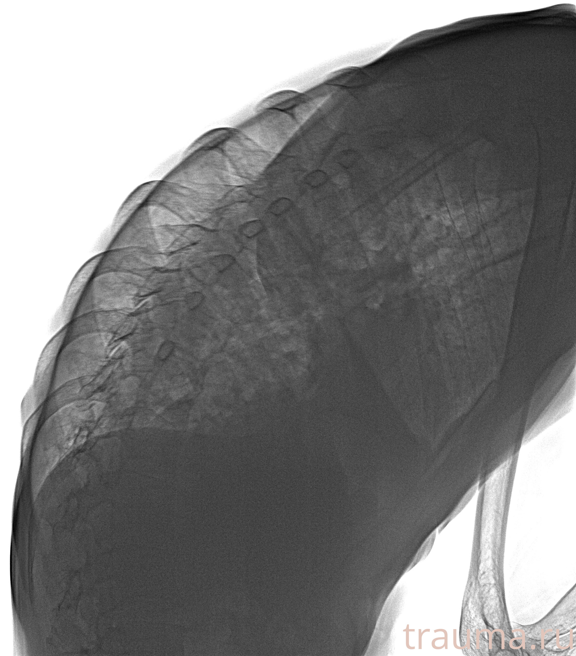 Рентген на дому: по вашему адресу приезжает врач-рентгенолог, травматолог-ортопед с мобильным рентгеновским аппаратом, проводит диагностику травмы или заболевания, делает необходимые рентгенограммы, дает рекомендации по дальнейшему лечению. Получить качественные снимки в домашних условиях возможно благодаря уникальной методике, разработанной МосРентген Центром для института  Склифосовского