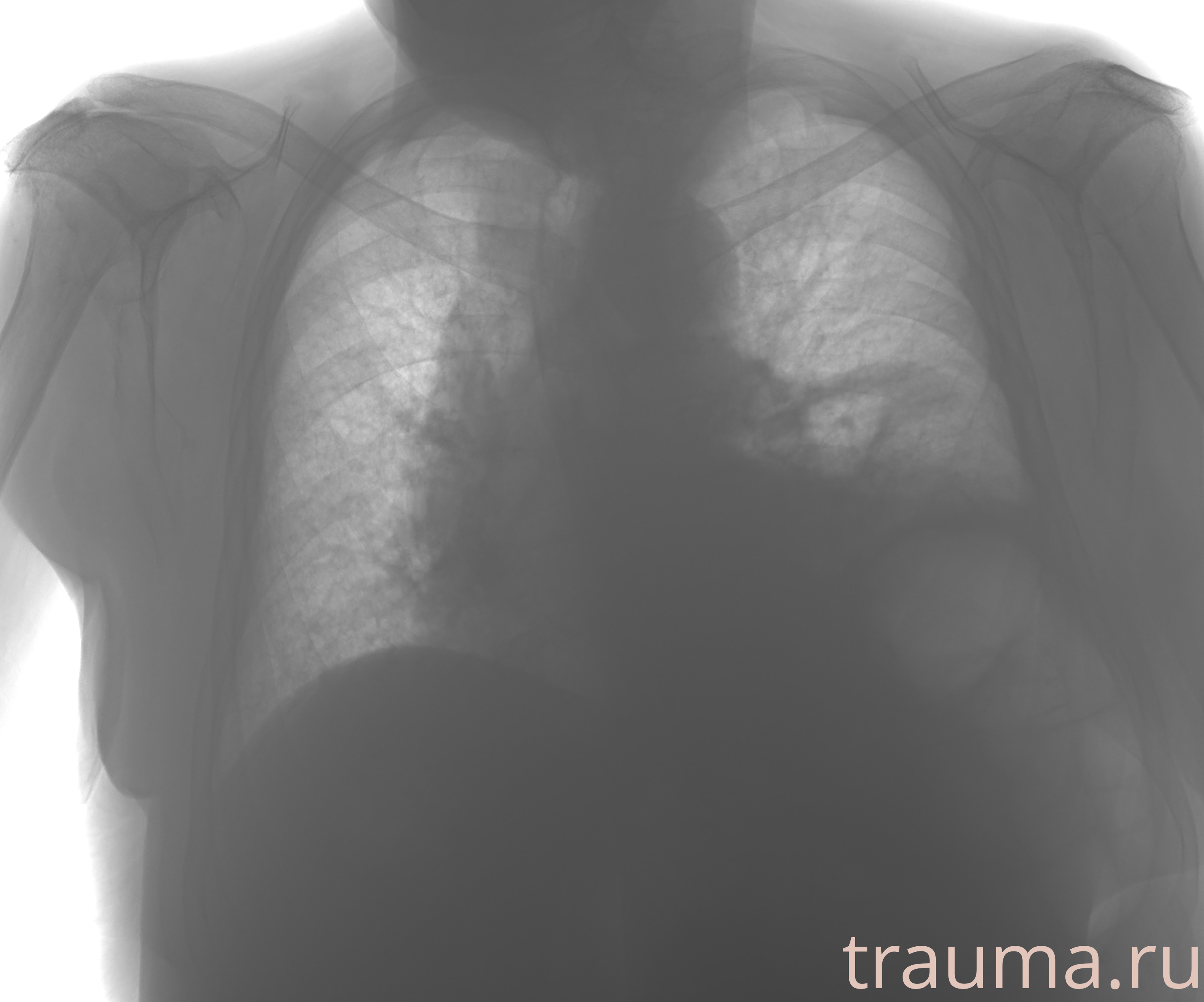 Рентген на дому: по вашему адресу приезжает врач-рентгенолог, травматолог-ортопед с мобильным рентгеновским аппаратом, проводит диагностику травмы или заболевания, делает необходимые рентгенограммы, дает рекомендации по дальнейшему лечению. Получить качественные снимки в домашних условиях возможно благодаря уникальной методике, разработанной МосРентген Центром для института  Склифосовского