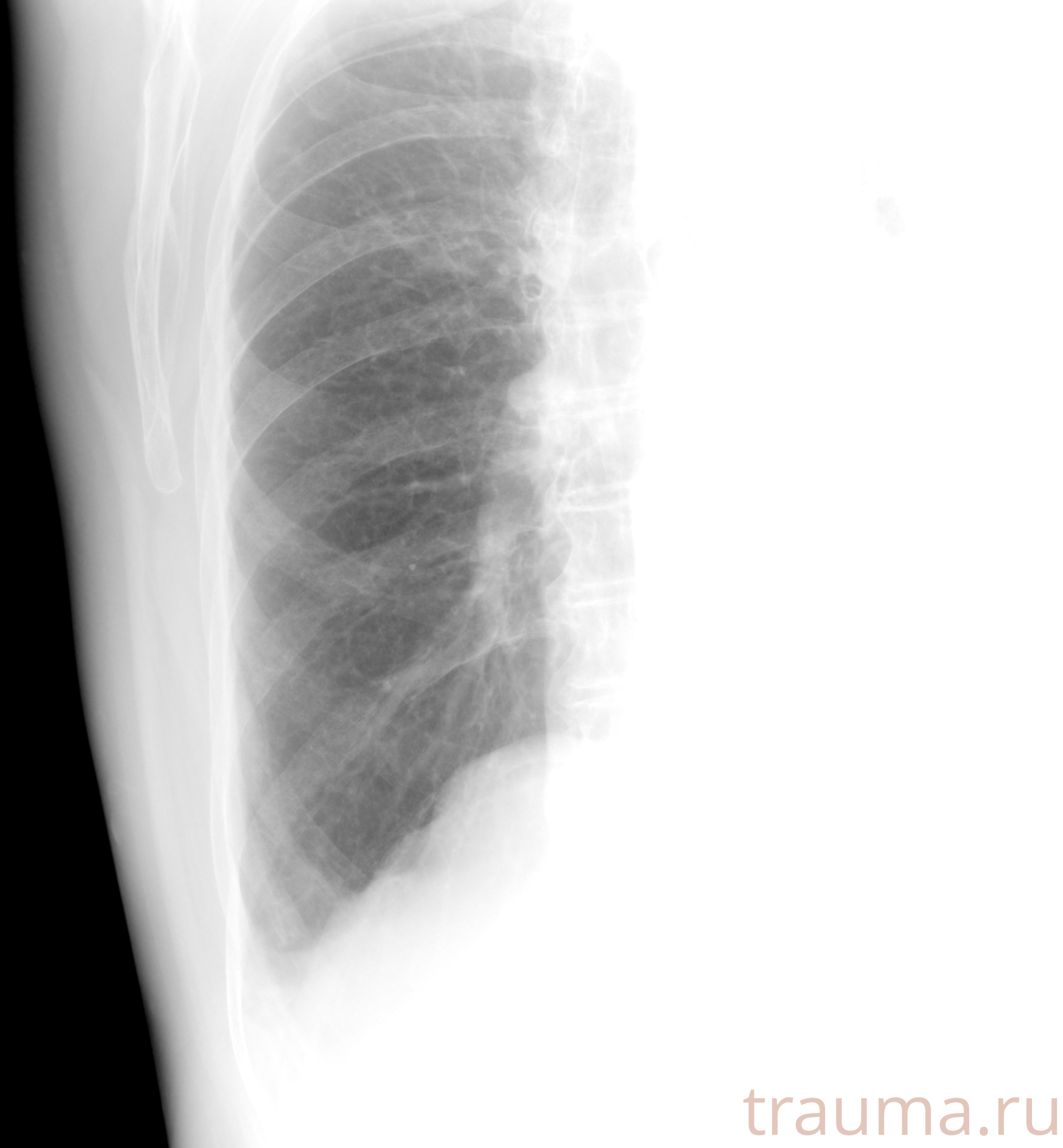 Рентген на дому: по вашему адресу приезжает врач-рентгенолог, травматолог-ортопед с мобильным рентгеновским аппаратом, проводит диагностику травмы или заболевания, делает необходимые рентгенограммы, дает рекомендации по дальнейшему лечению. Получить качественные снимки в домашних условиях возможно благодаря уникальной методике, разработанной МосРентген Центром для института  Склифосовского