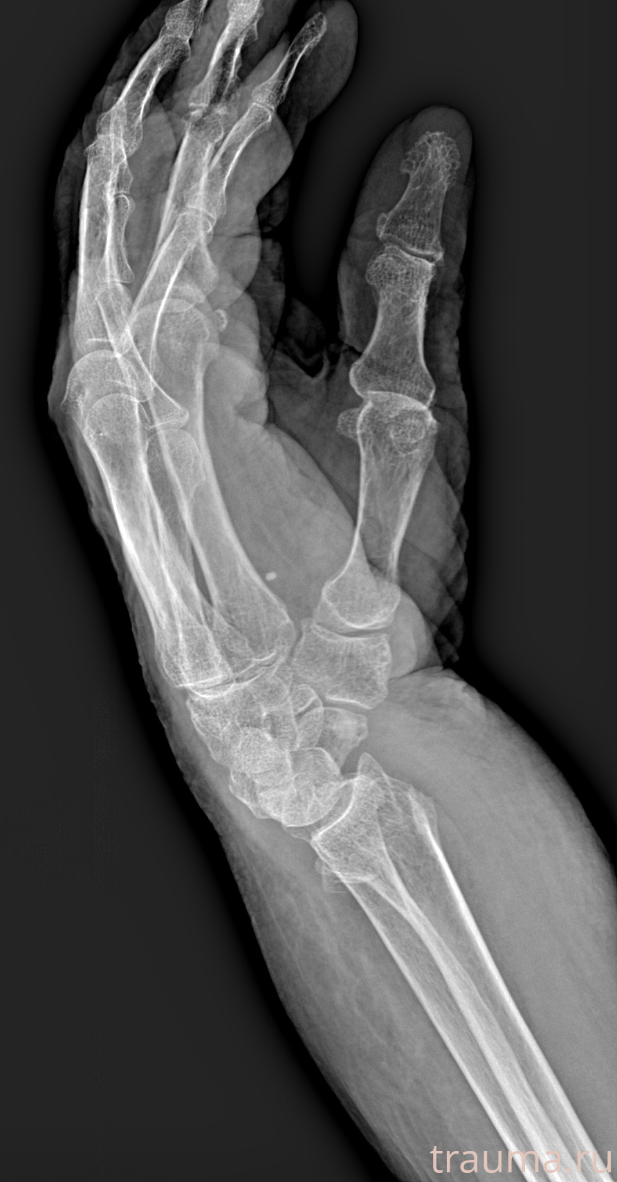 Рентген на дому: по вашему адресу приезжает врач-рентгенолог, травматолог-ортопед с мобильным рентгеновским аппаратом, проводит диагностику травмы или заболевания, делает необходимые рентгенограммы, дает рекомендации по дальнейшему лечению. Получить качественные снимки в домашних условиях возможно благодаря уникальной методике, разработанной МосРентген Центром для института  Склифосовского