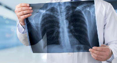 Больницы Ямала получили флюорограф, аппараты для рентгена и выявления диабета Больницы Ямала получили флюорограф, аппараты для рентгена и выявления диабета